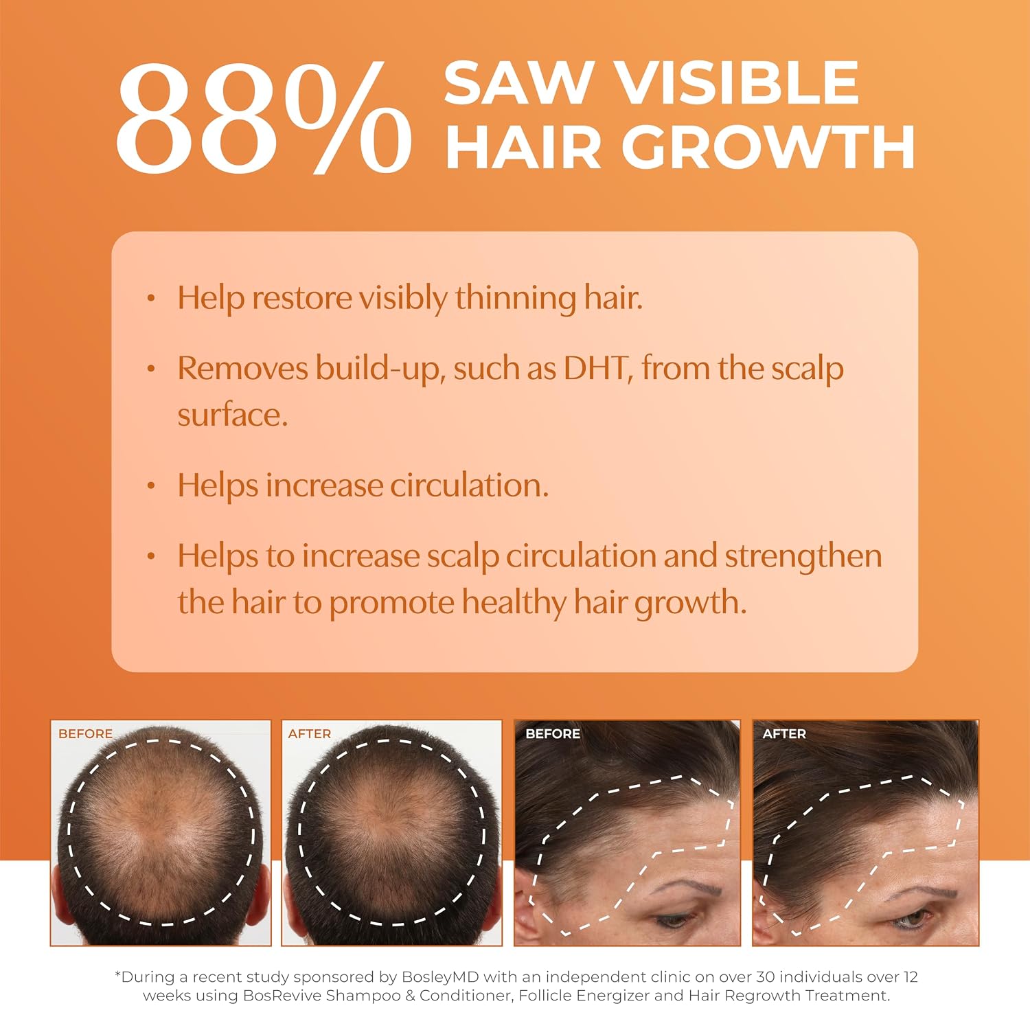Detalle 2 de BosleyMD BosRevive BP-BRST001 Hair Care Kit for Thinning, Color-Treated Hair