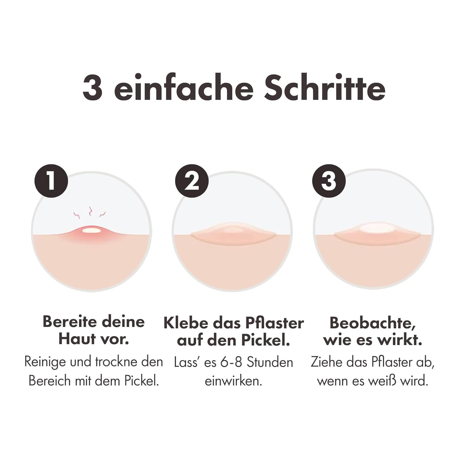 Detalle 2 de Hydrokolloid-Pickelpatch 39 Stück von Hero Cosmetics