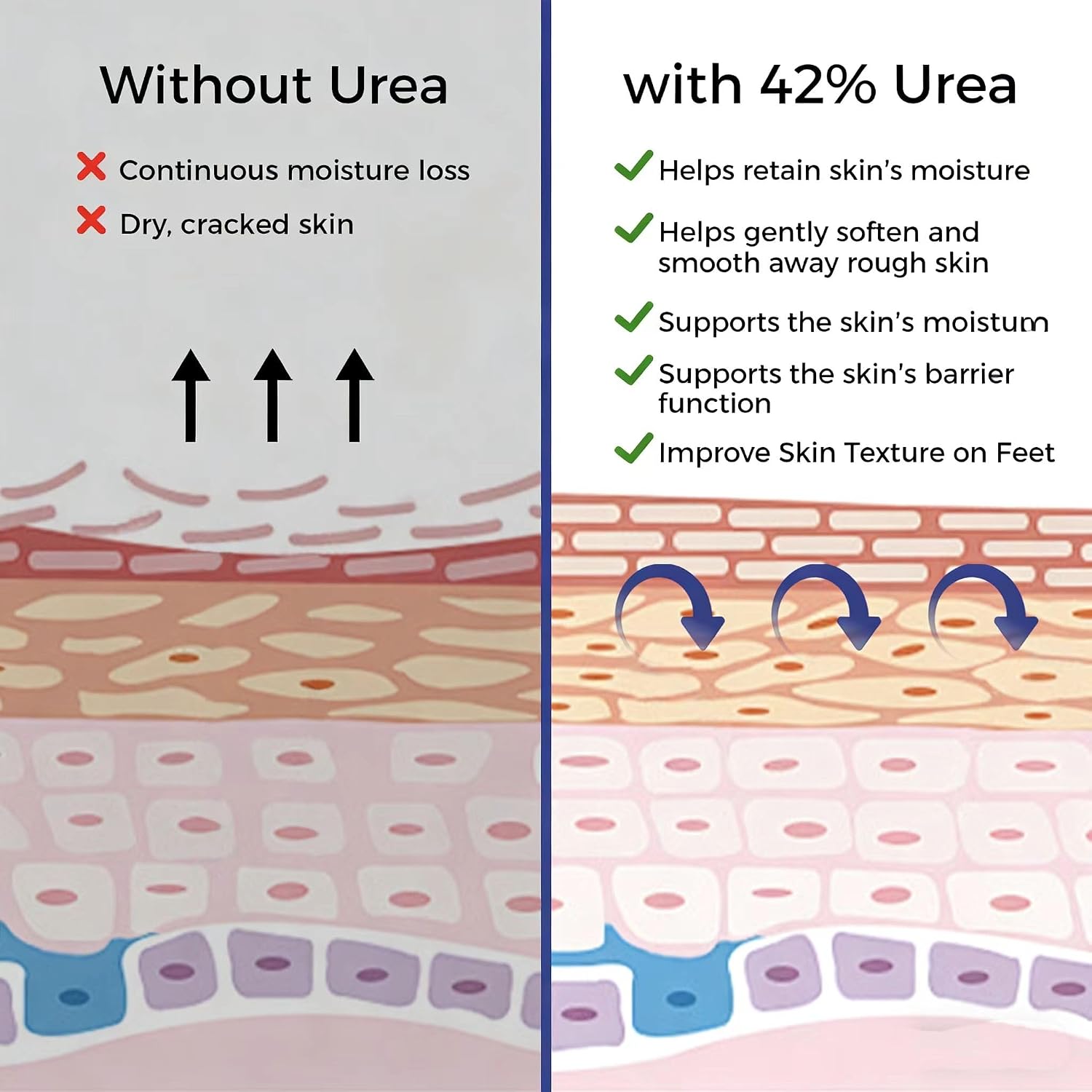 Thumbnail 4 de OUKEYA Urea-Creme 42% plus Salicylsäure 2% – Harnstoffcreme