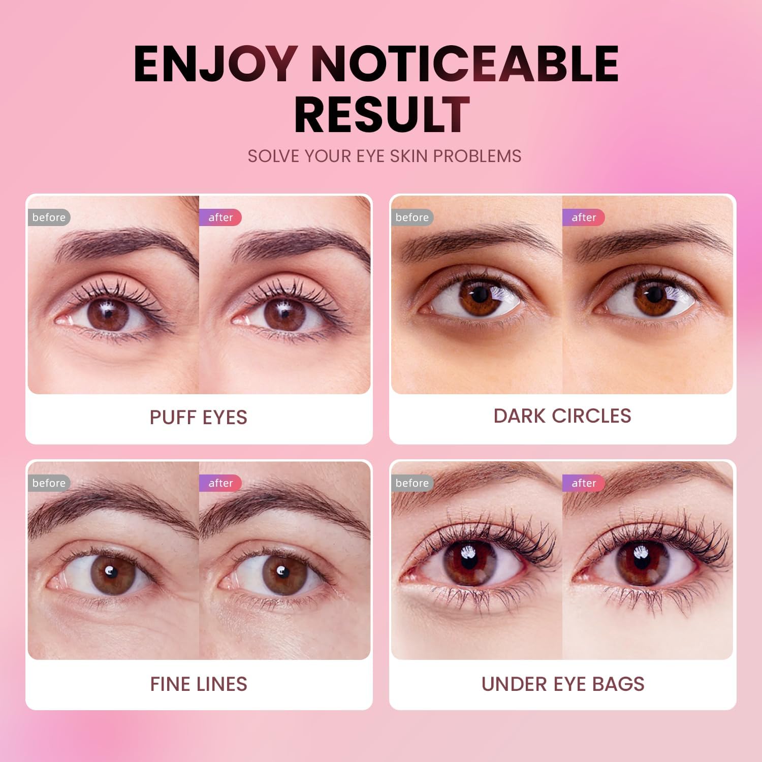 Thumbnail 4 de AILEORY Under Eye Patches (24 Pairs) Tri-Color Glitter Gel Patches for Dark Circles & Puffy Eyes