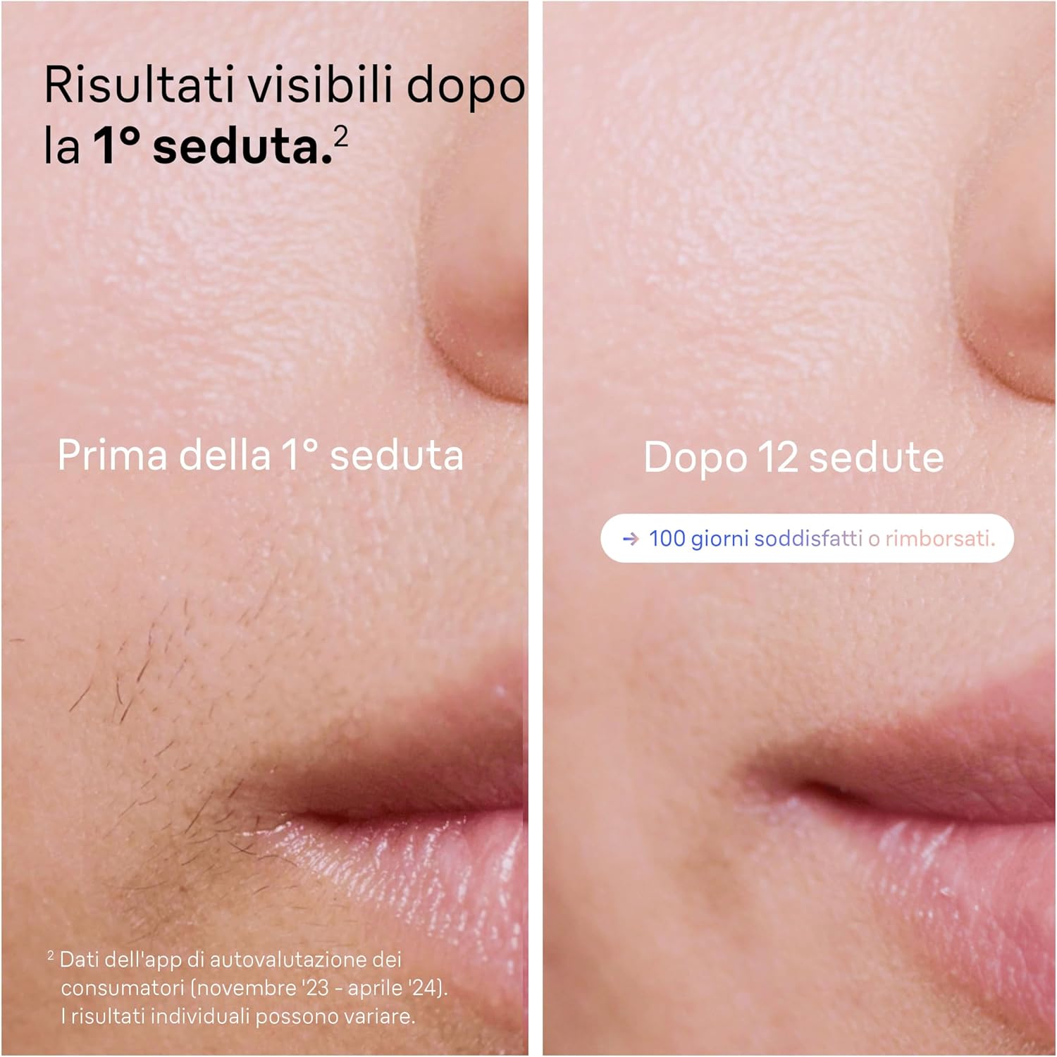 Thumbnail 3 de Braun Skin I·Expert Epilatore Luce Pulsata