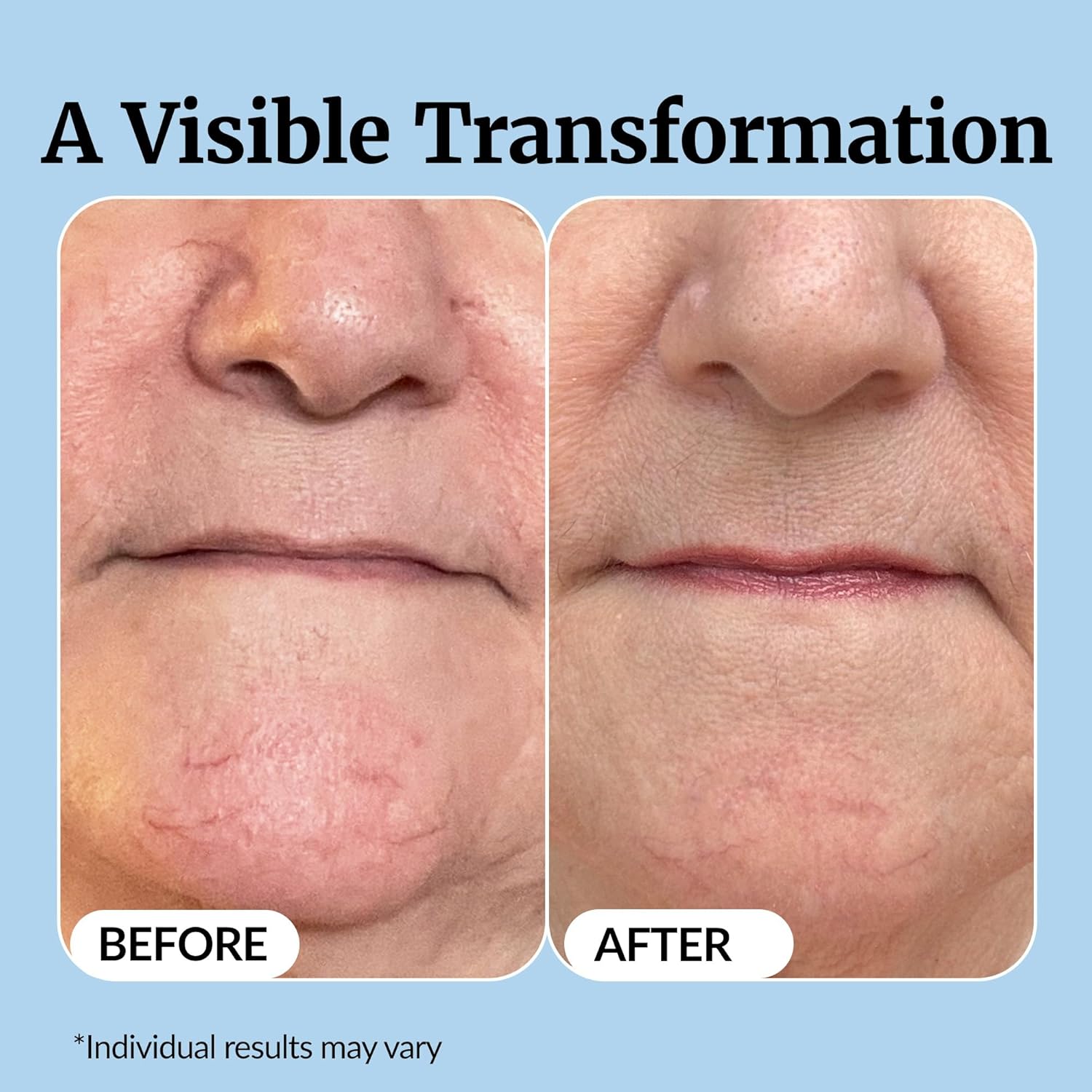 Thumbnail 4 de Vibriance Super C Serum for Mature Skin — Vitamin Formula 1 oz