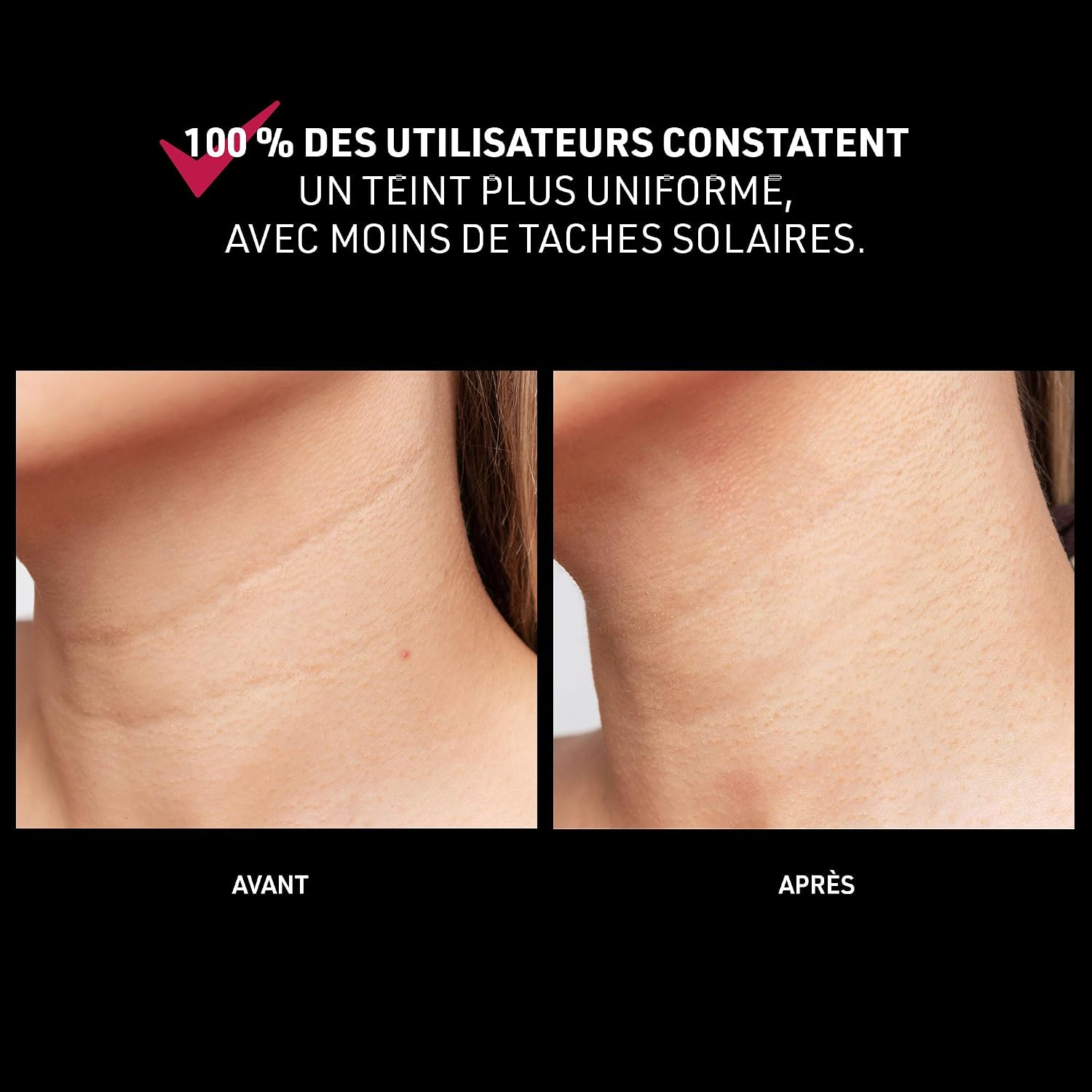 Thumbnail 4 de FAQ 211 Masque cou et décolleté anti-âge 761 LED