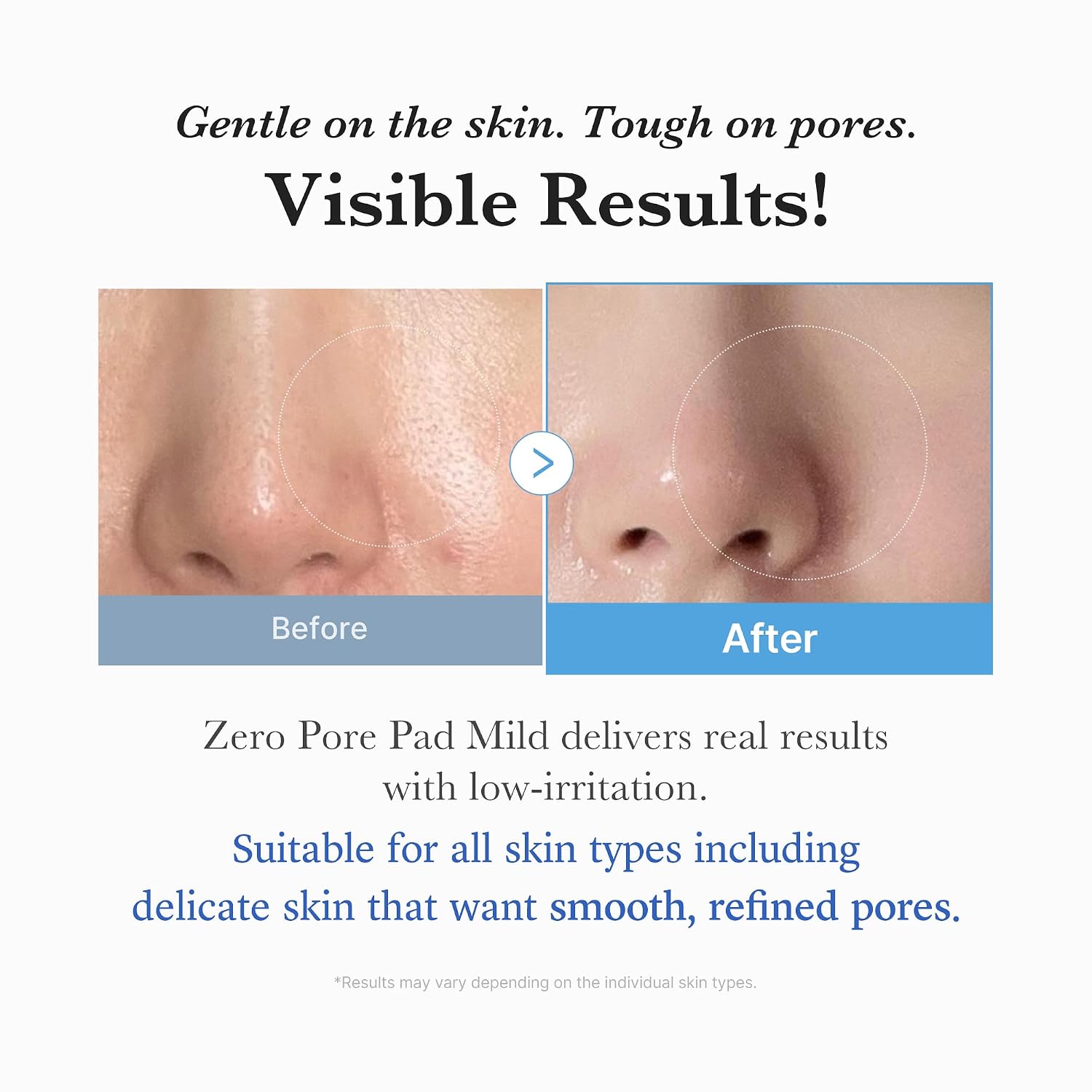 Thumbnail 4 de medicube Zero Pore Gentle Tonerpads 70 Einheiten