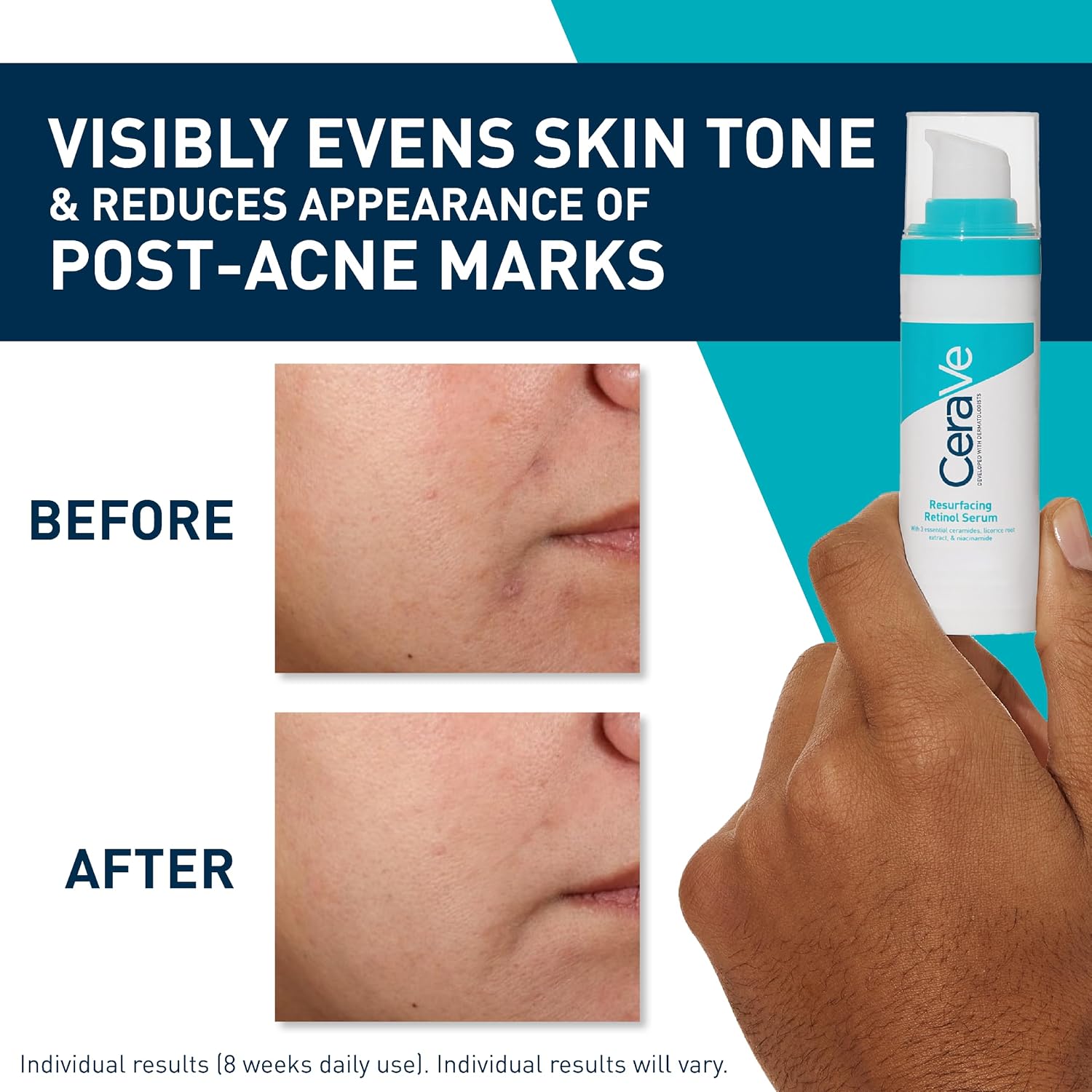 Thumbnail 4 de CeraVe Resurfacing Retinol Serum 30ml