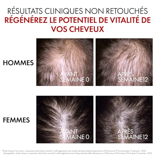 Thumbnail 2 de Vichy Dercos Aminexil Clinical Sérum Anti-Chute 1,5% – 90 ml