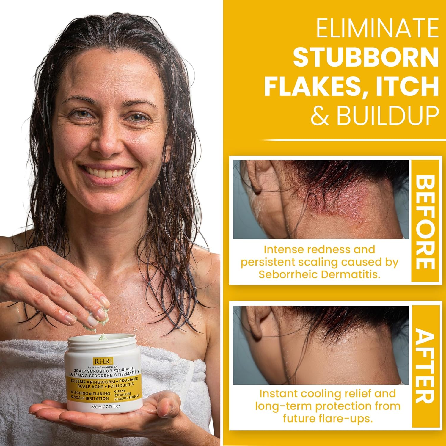 Thumbnail 2 de Anti Fungal Pre Shampoo Scalp Scrub
