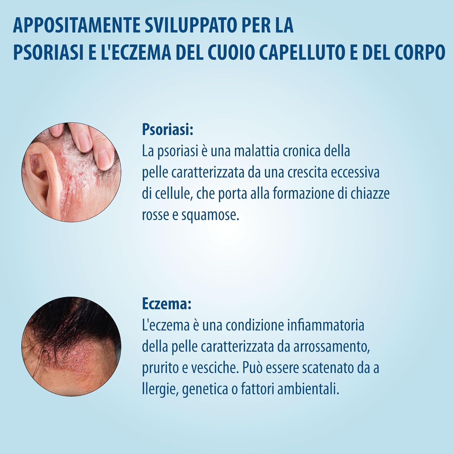 Thumbnail 5 de Evolsin Shampoo 250 ml contro eczema