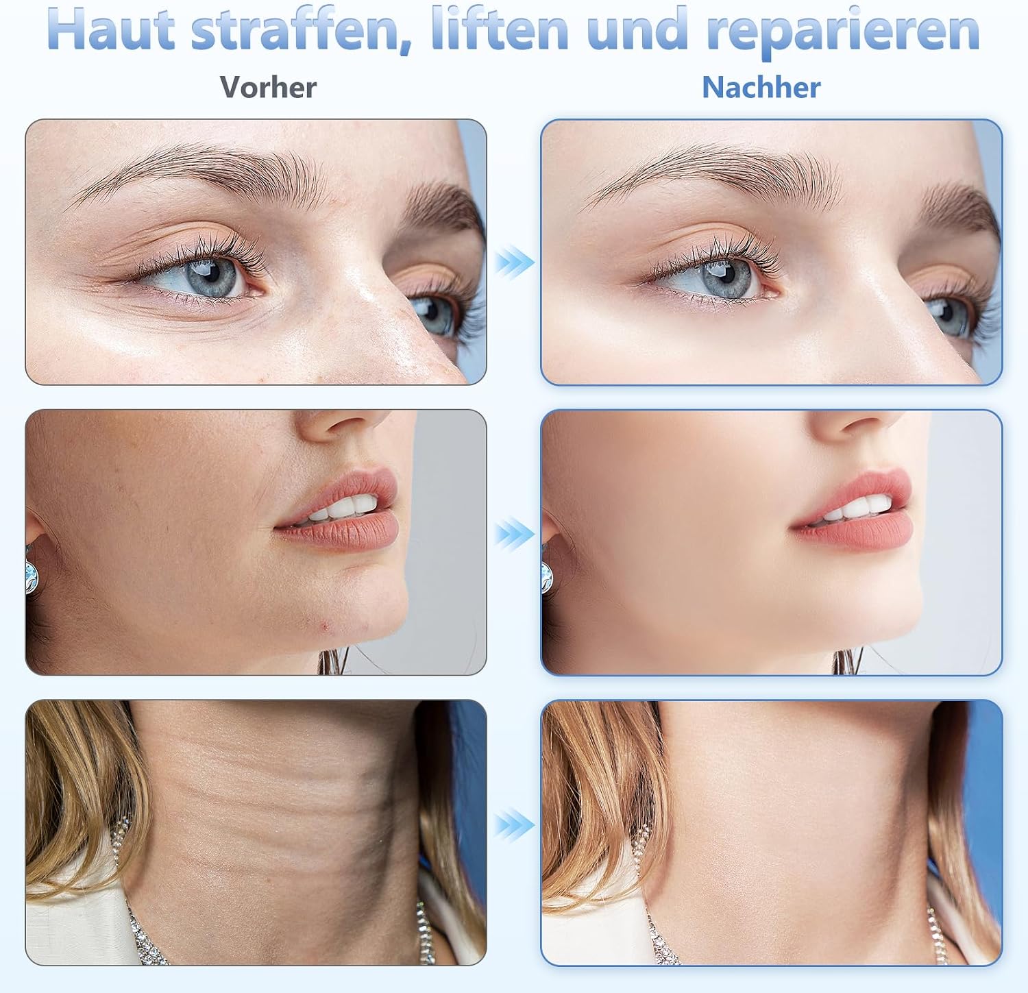 Detalle de karzu EMS-Gesichtsmassagegerät 45 °C