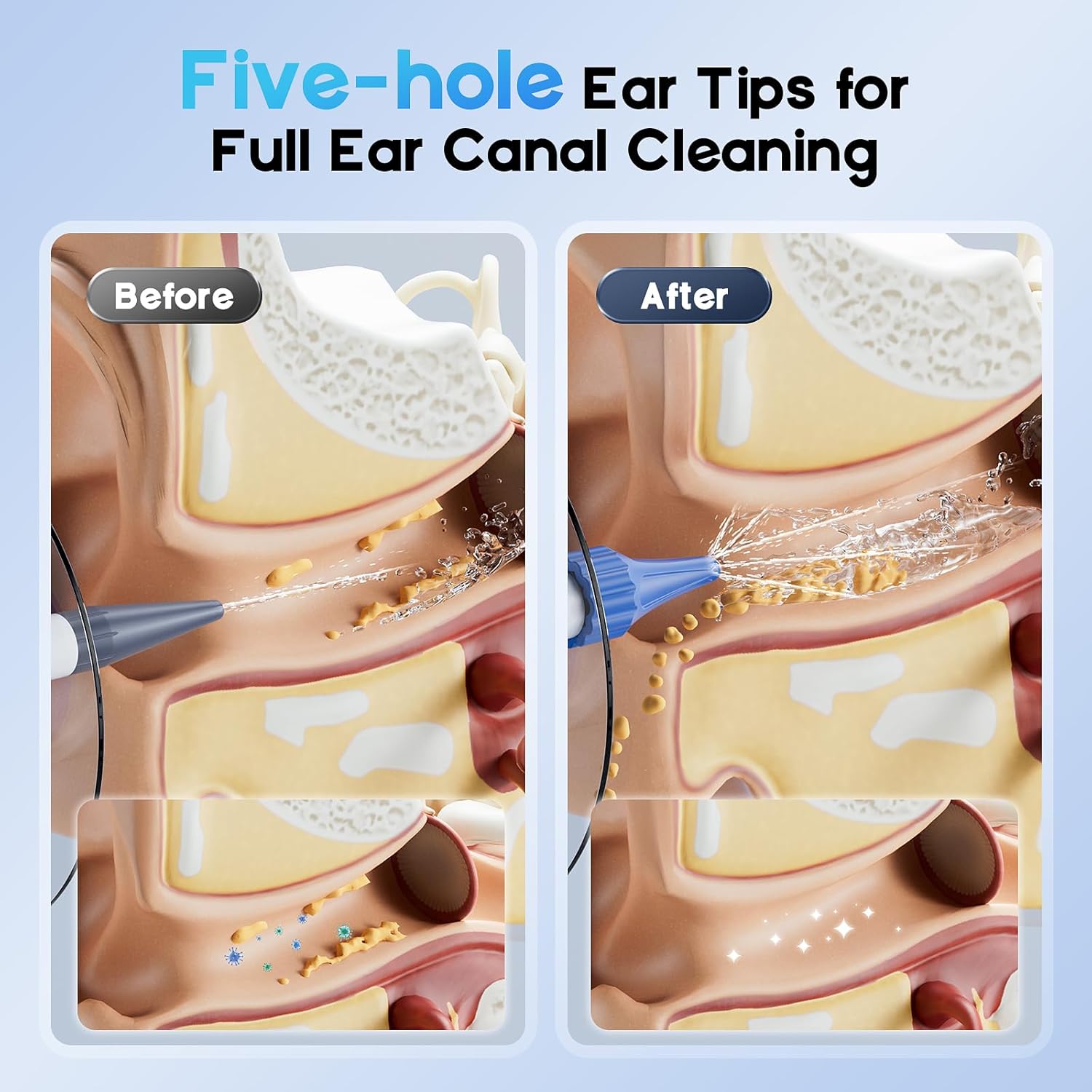 Detalle 2 de Ear Wax Removal: Electric Ear Cleaning Kit with Light and 4 Modes