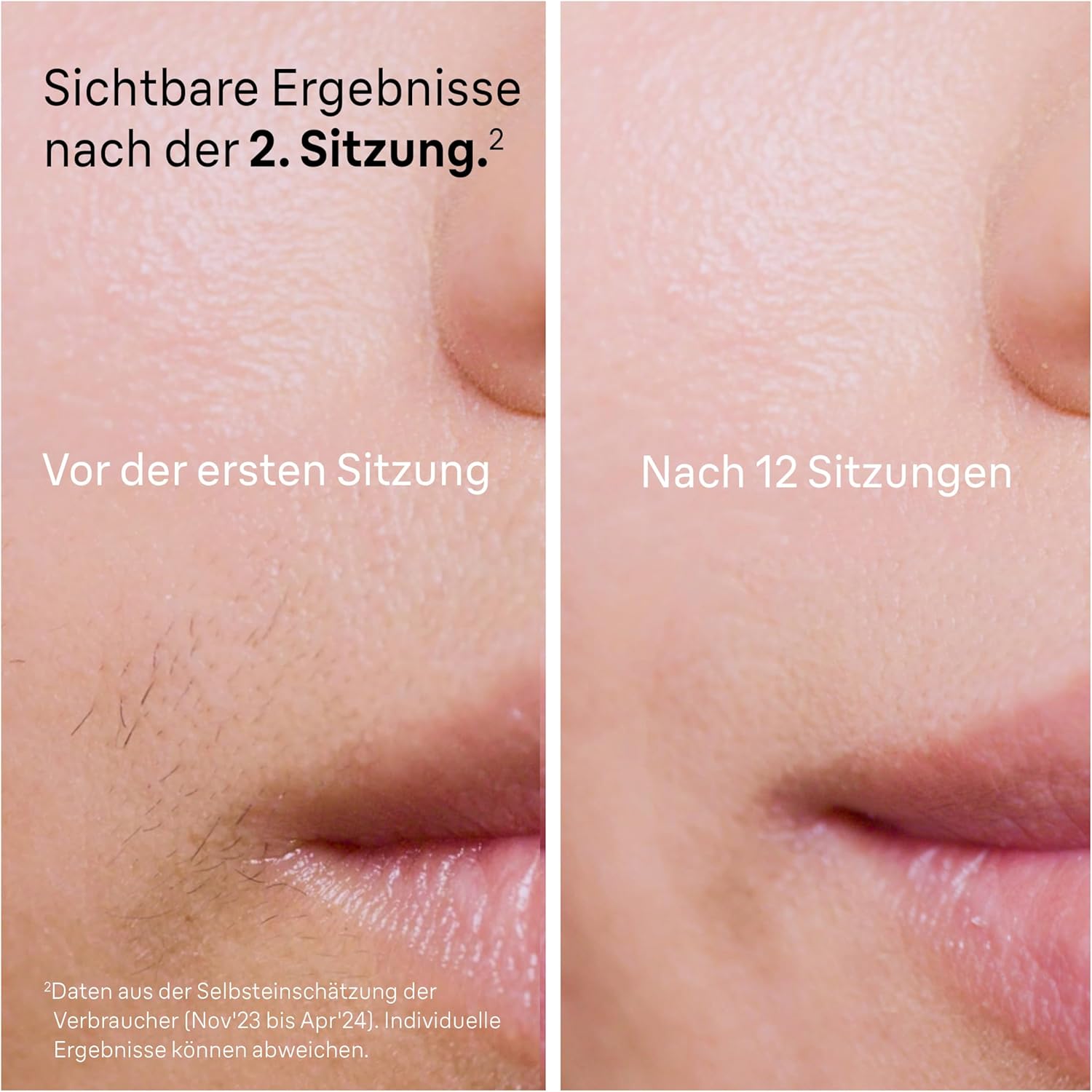 Thumbnail 3 de Braun Silk·expert Pro 5 IPL Haarentfernung (PL5262) für Zuhause – inkl. Etui, Venus Rasierer & 3 Aufsätzen, Weiß/Gold