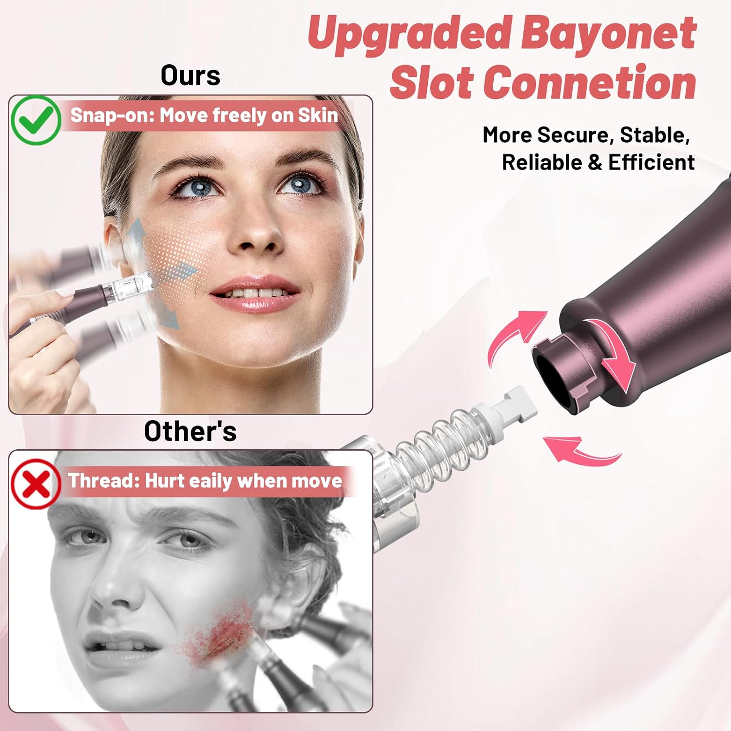 Detalle de Buyounger Dr. Pen 2025 Ultima A10 Professioneller Microneedling Pen (kabellos) mit 25 Ersatzkartuschen