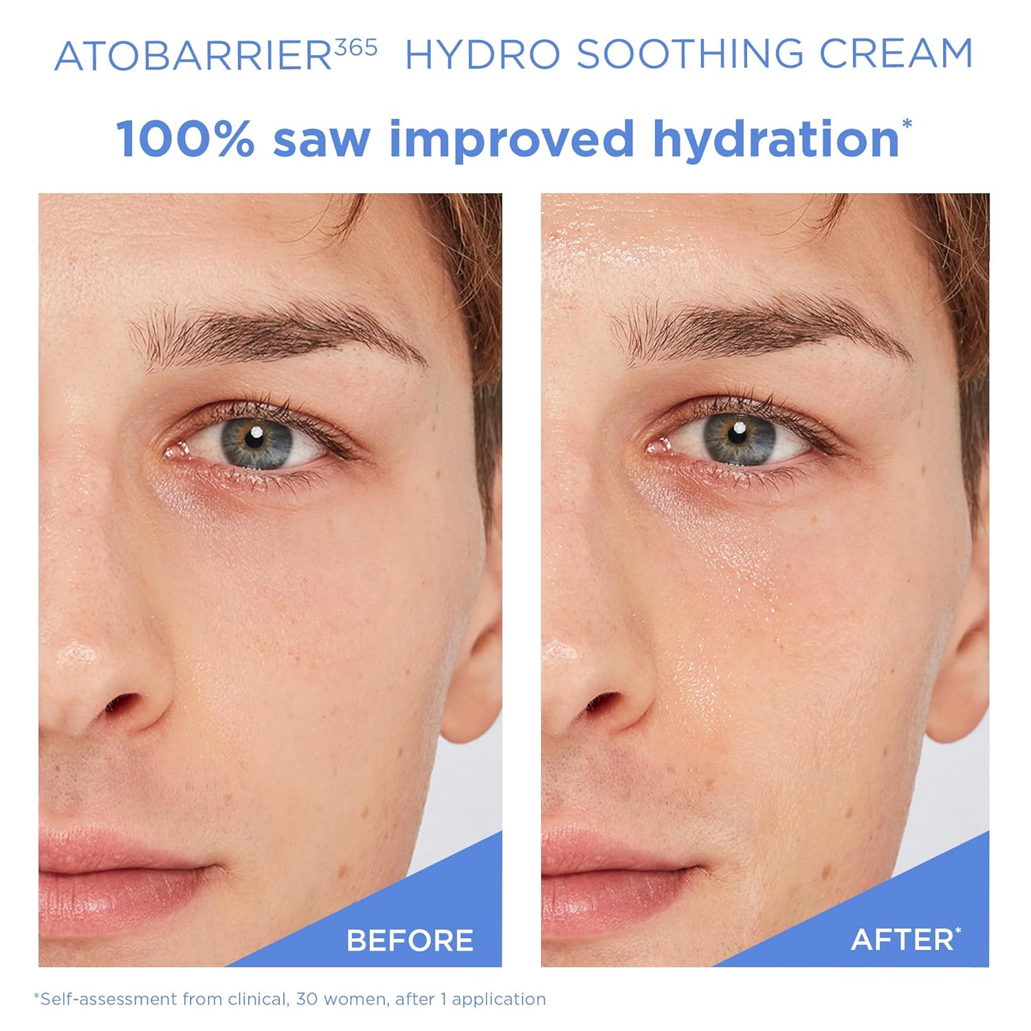 Thumbnail 4 de AESTURA ATOBARRIER365 Hydro Soothing Gel Cream: Lightweight Ceramide Hydration for Sensitive Skin