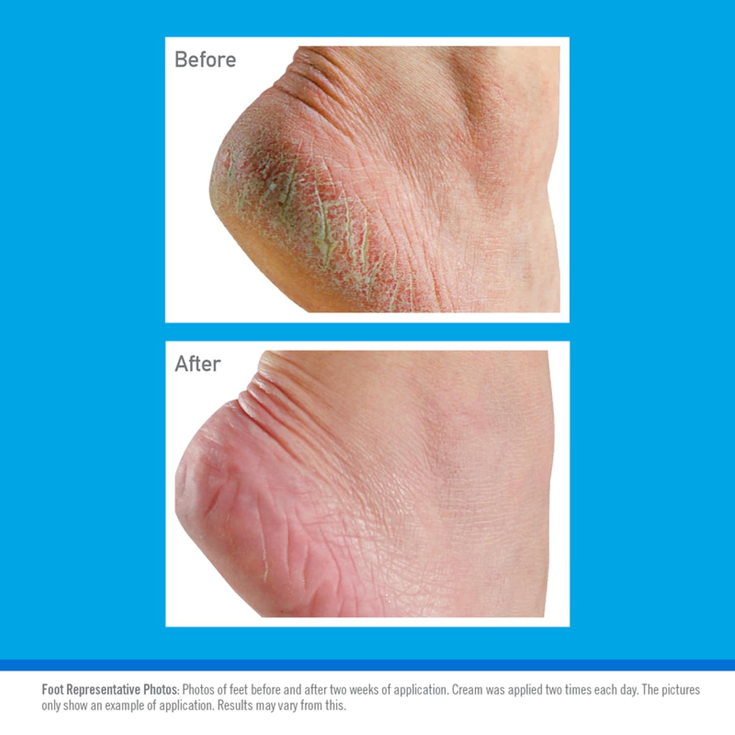 Thumbnail 2 de O'Keeffe's Healthy Feet Jar 91g — Foot Cream for Very Dry Skin
