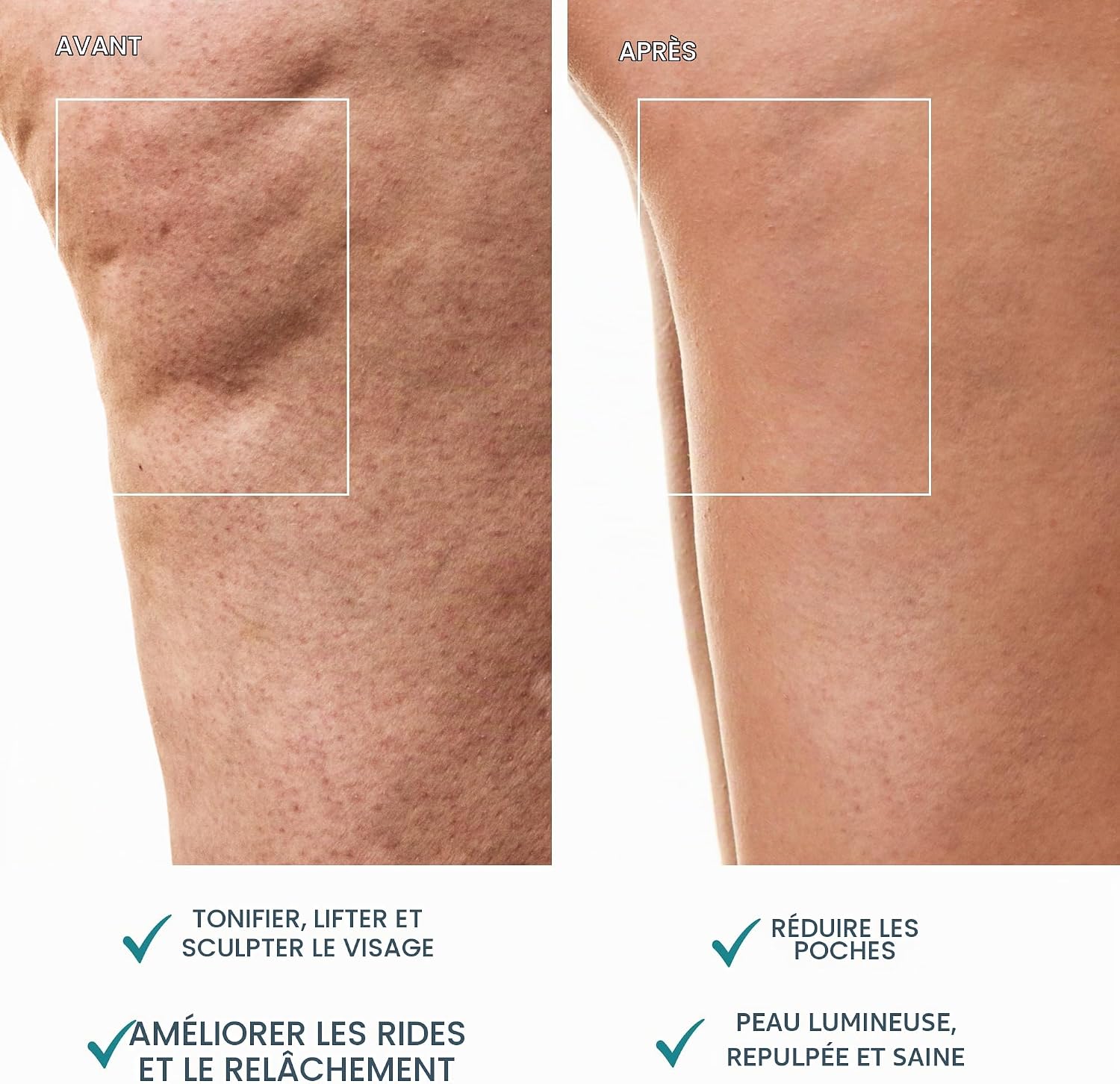 Detalle de FOREO BEAR 2 Body — Appareil de massage corps sculptant à micro-courant avancé
