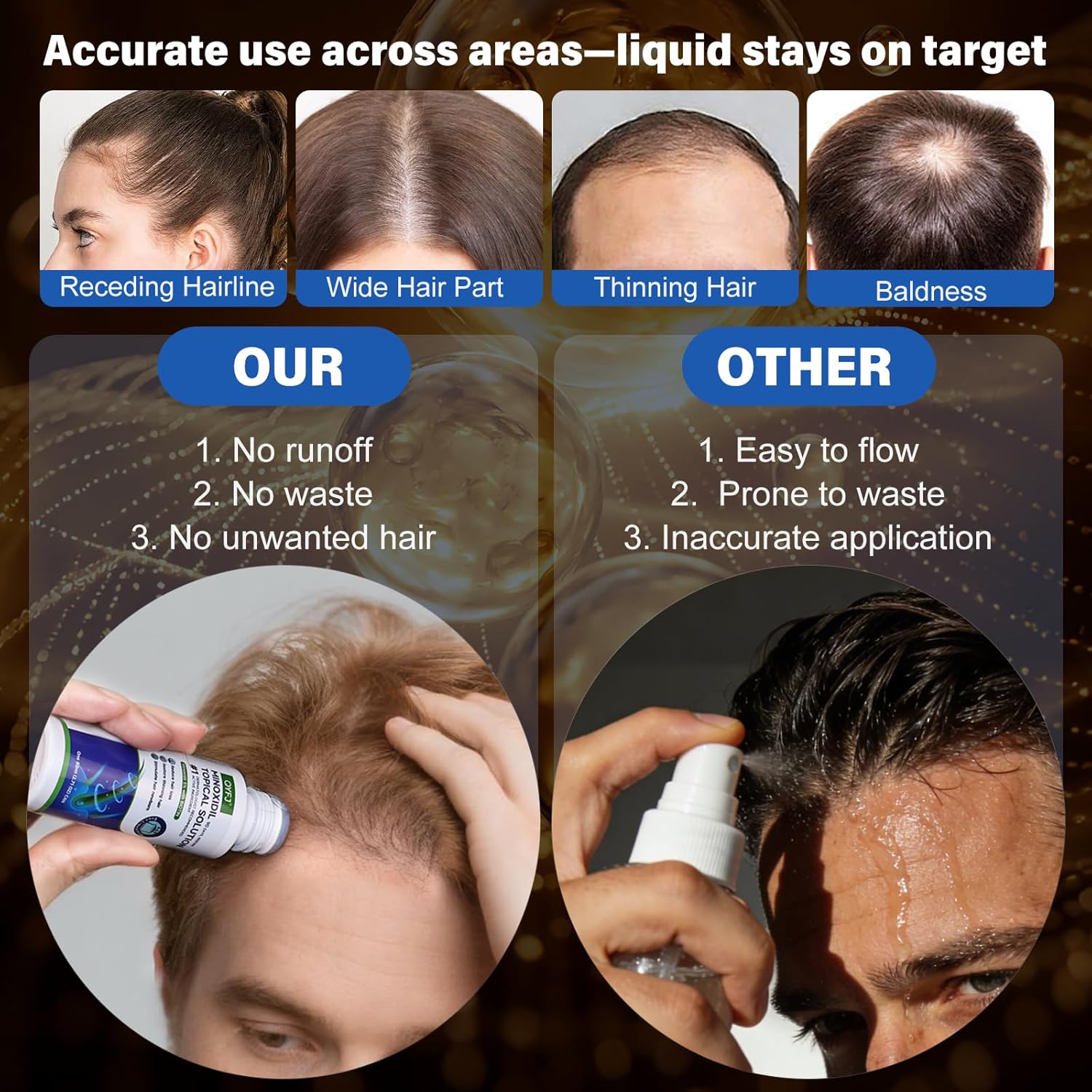 Detalle de 6 Pack 5% Minoxidil Hair & Beard Growth Serum with Sponge Applicator (Unscented, Biotin-Infused) — 2.7 fl oz x 6