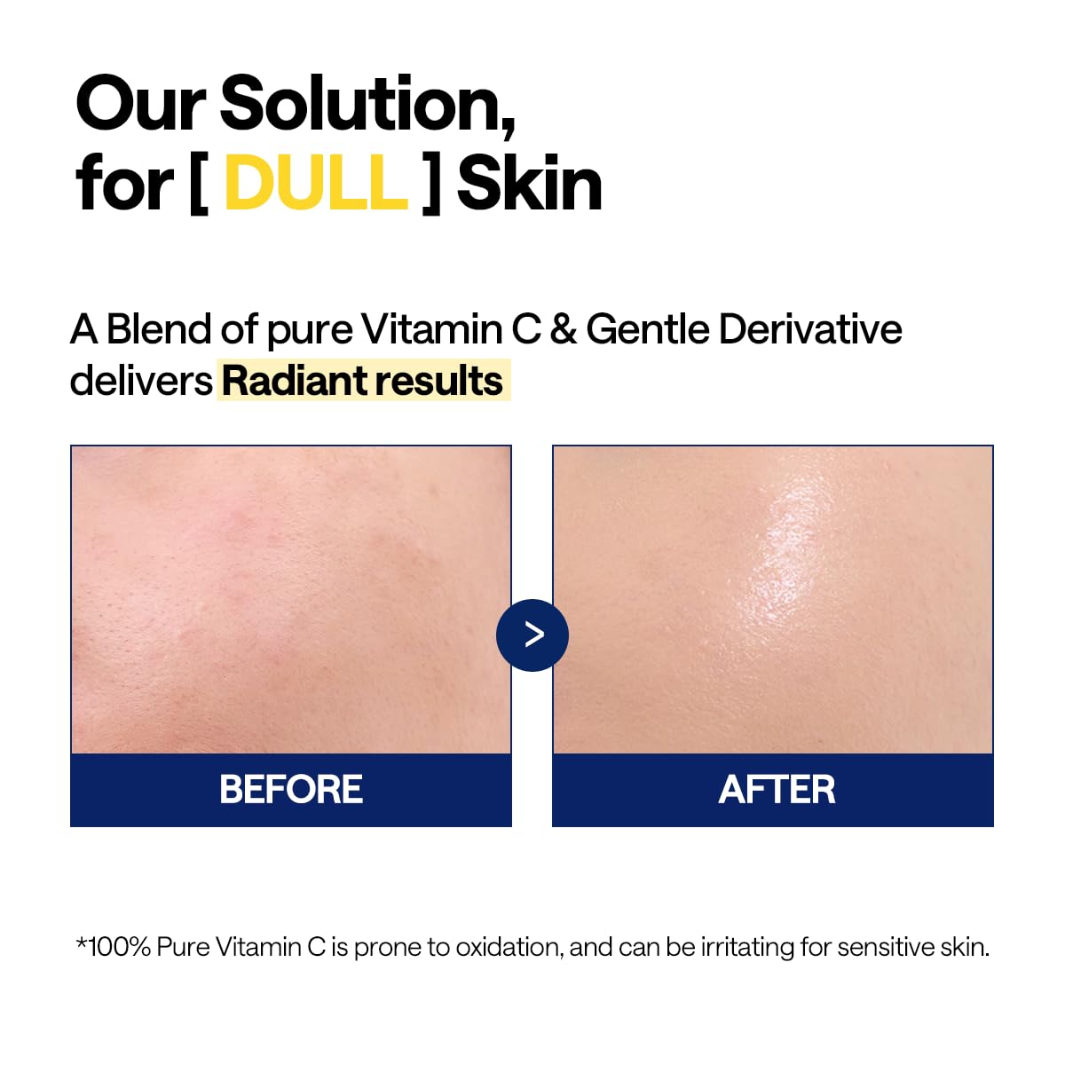 Thumbnail 5 de Mediheal Vitamin C Brightening Serum (1.35 fl oz) – Tone-Texture-Glow Care