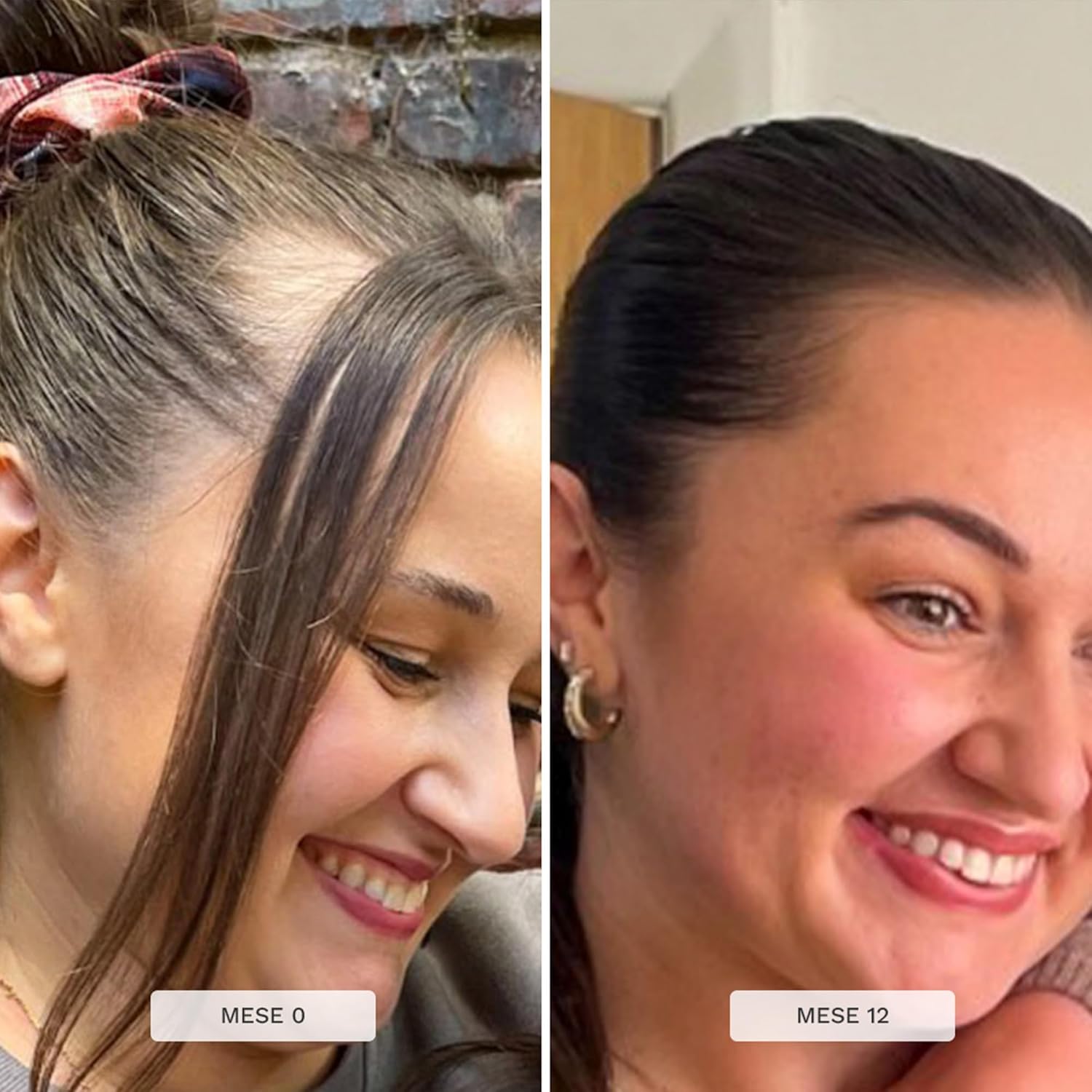 Thumbnail 5 de HAIR BURST Shampoo e Balsamo in set per la crescita dei capelli (senza SLS e parabeni)