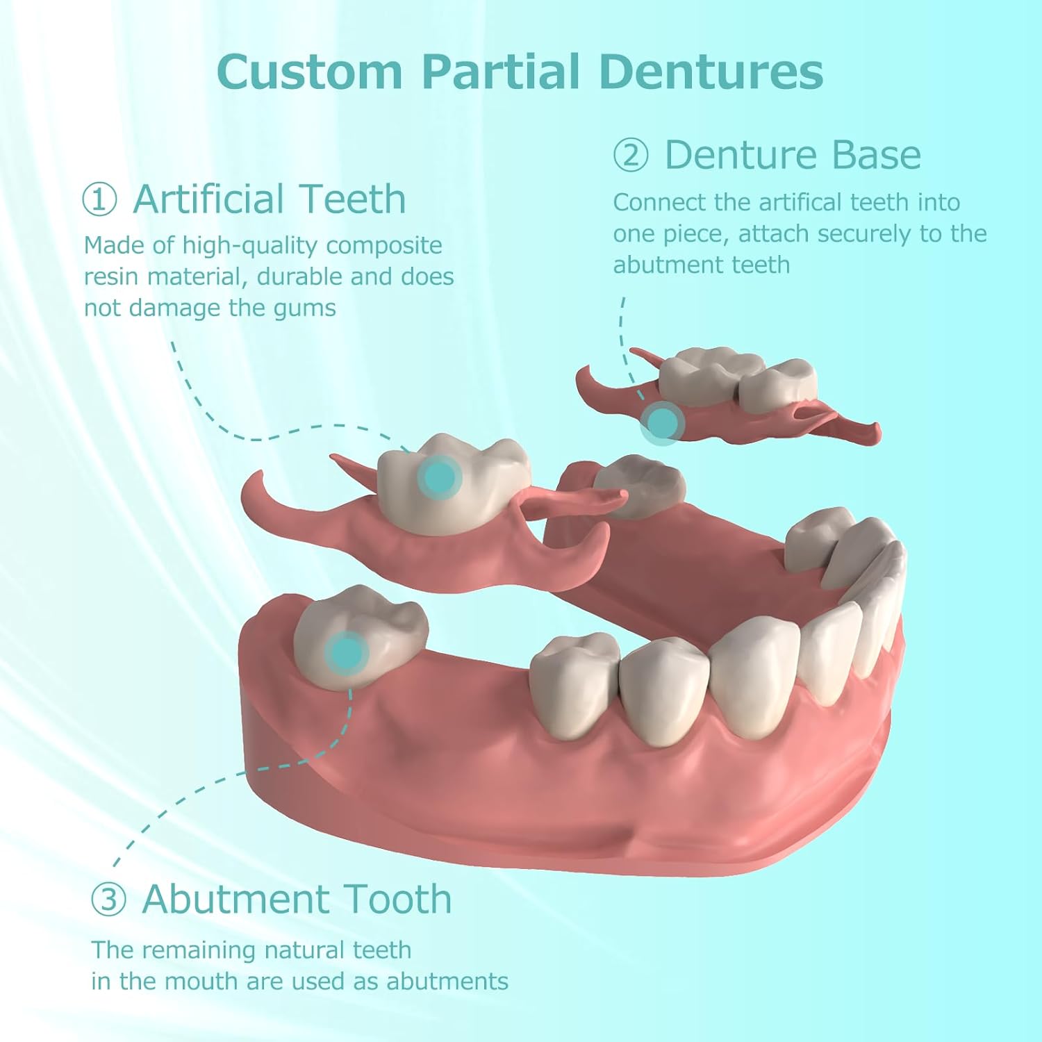 Thumbnail 2 de Partial denture kit for 1 missing tooth