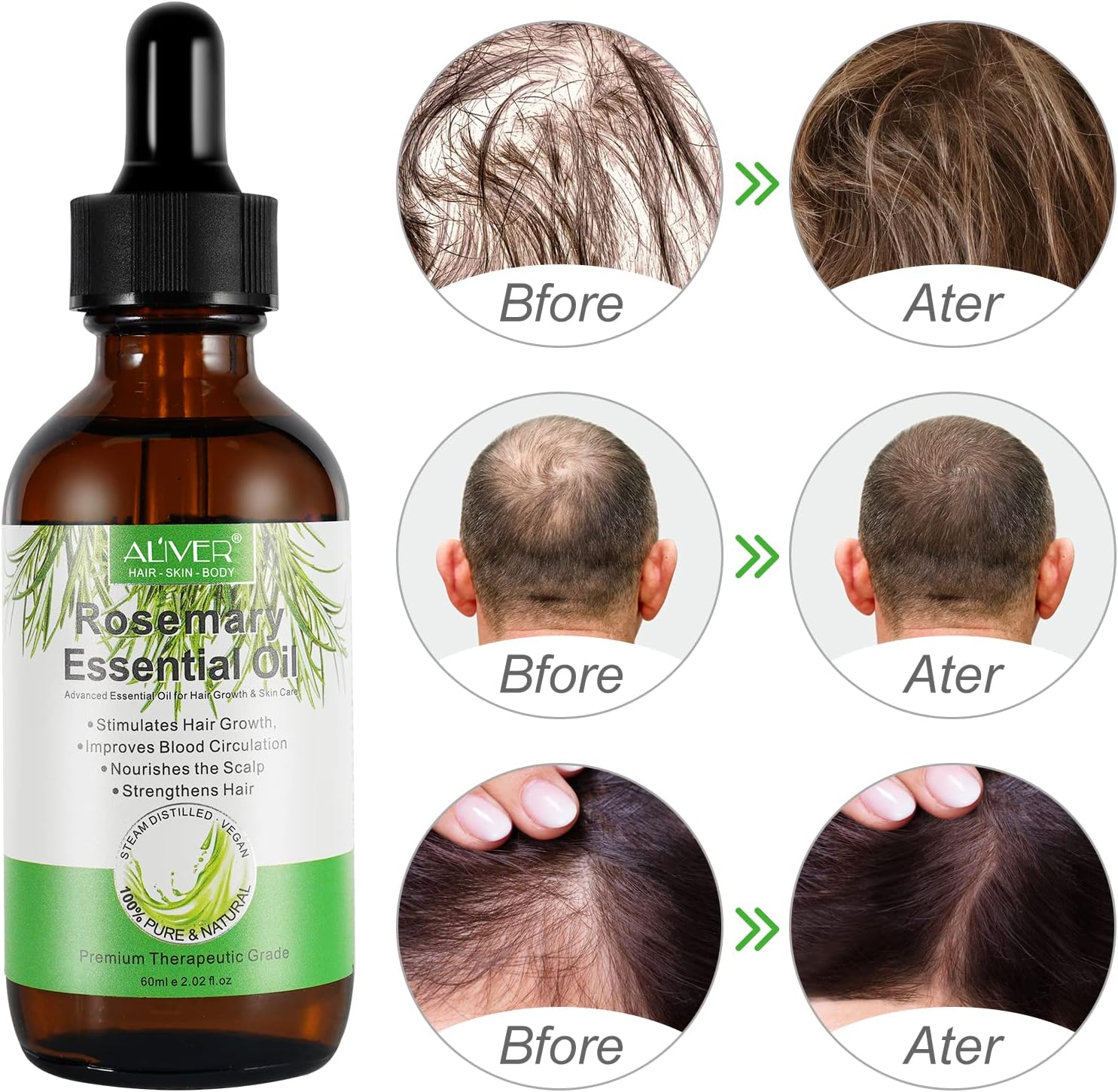 Thumbnail 3 de Huile de Romarin 2 paquets pour cheveux