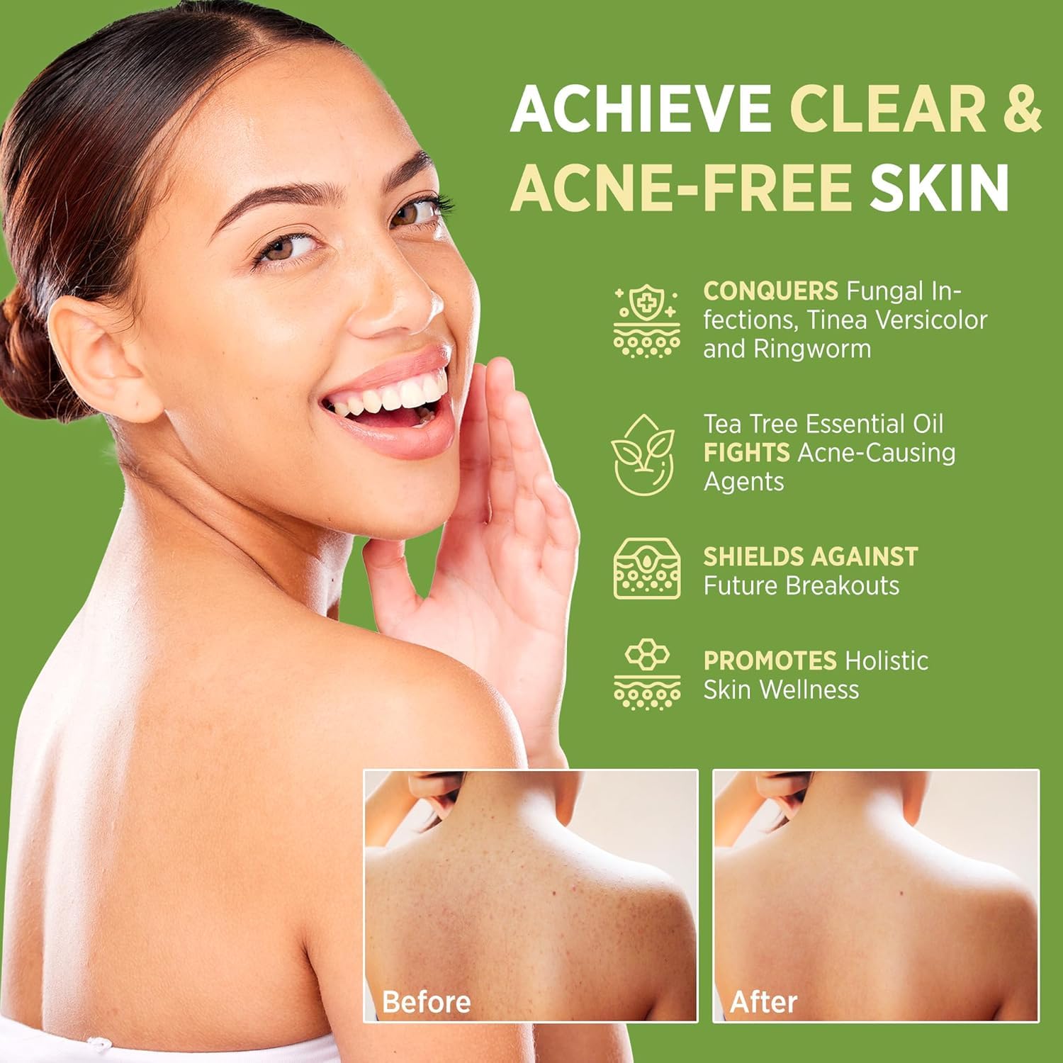 Detalle 2 de Roycederm Tea Tree Soap – Teebaumöl Seife
