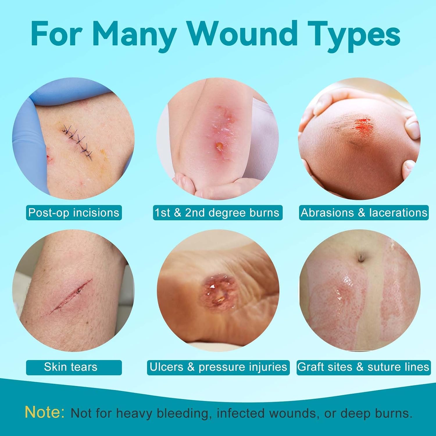 Thumbnail 4 de Dimora Silicone Wound Contact Layer: Transparent Non-Adhering Dressing Pads (3in x 4in) – 10 pcs