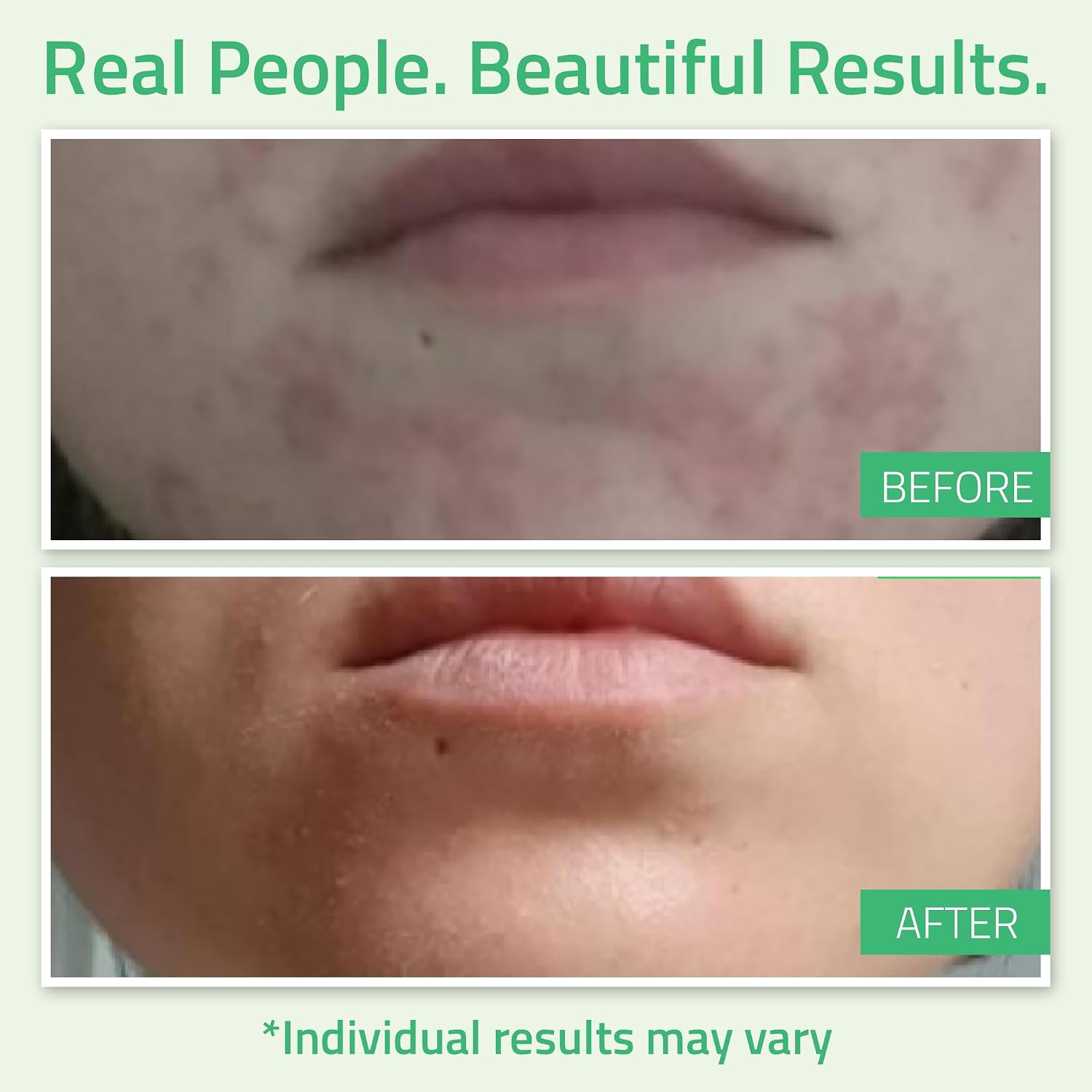 Detalle 2 de YEOUTH Acido Glicolico peeling viso 30%