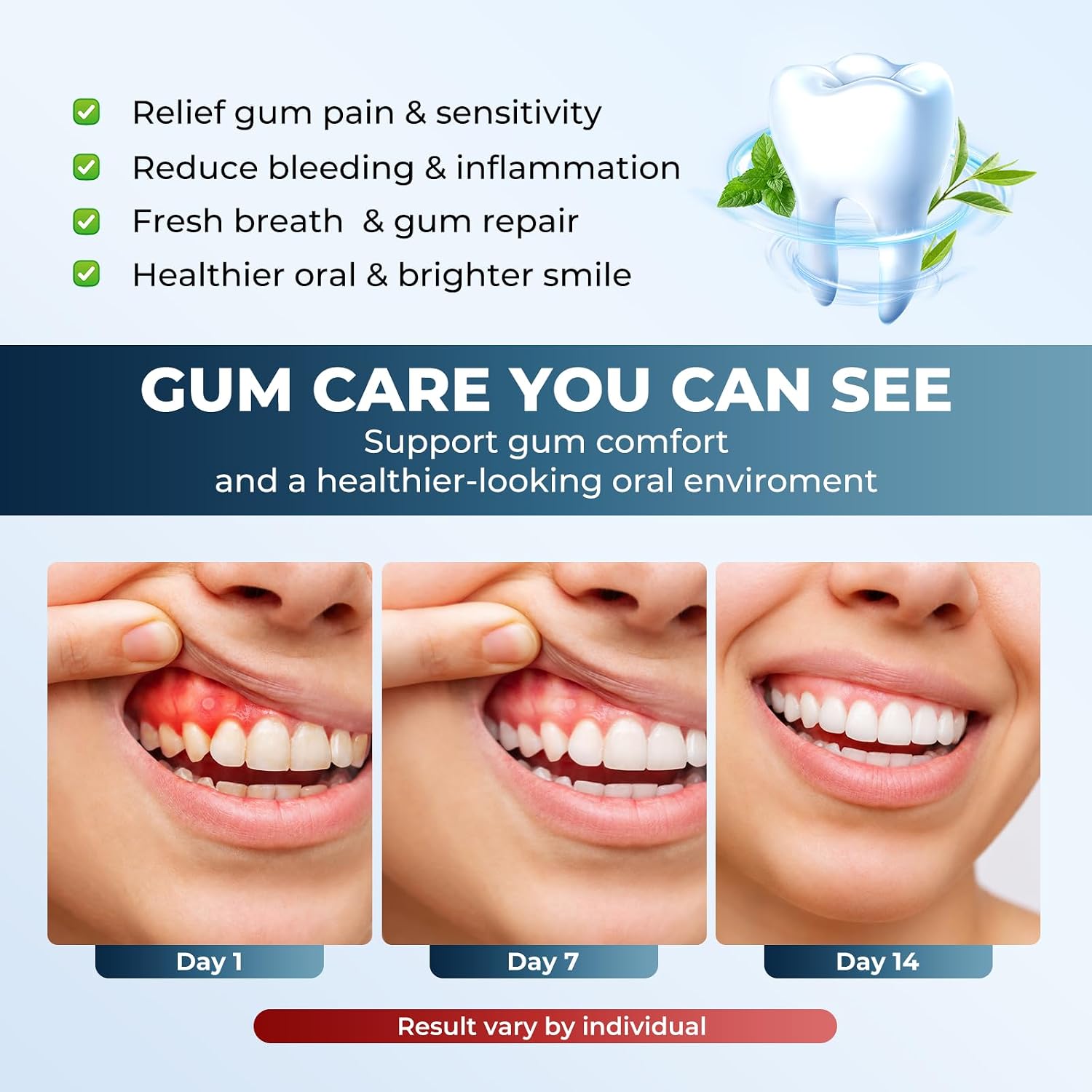Thumbnail 3 de KTS Oral Care Light with Red & Blue LEDs and Smart Controller