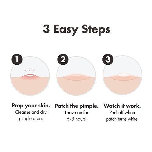 Detalle 2 de Mighty Patch Original Spot Patches by HERO COSMETICS (36 patches) – Overnight Hydrocolloid Acne Treatment