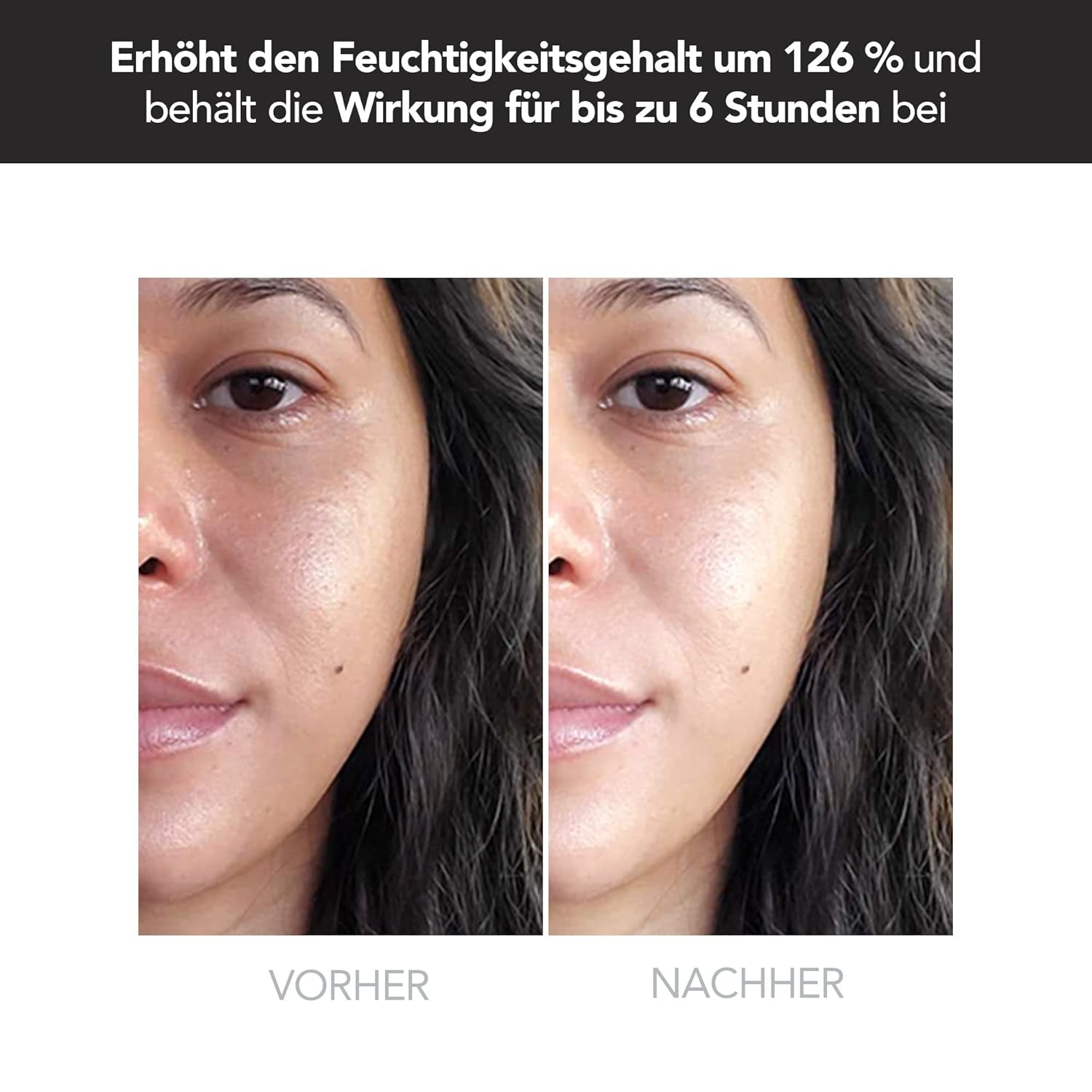 Thumbnail 4 de Foreo Ufo 2 LED-Gesichtsmaske mit Wärme, Kühlung und Gesichtsmassage