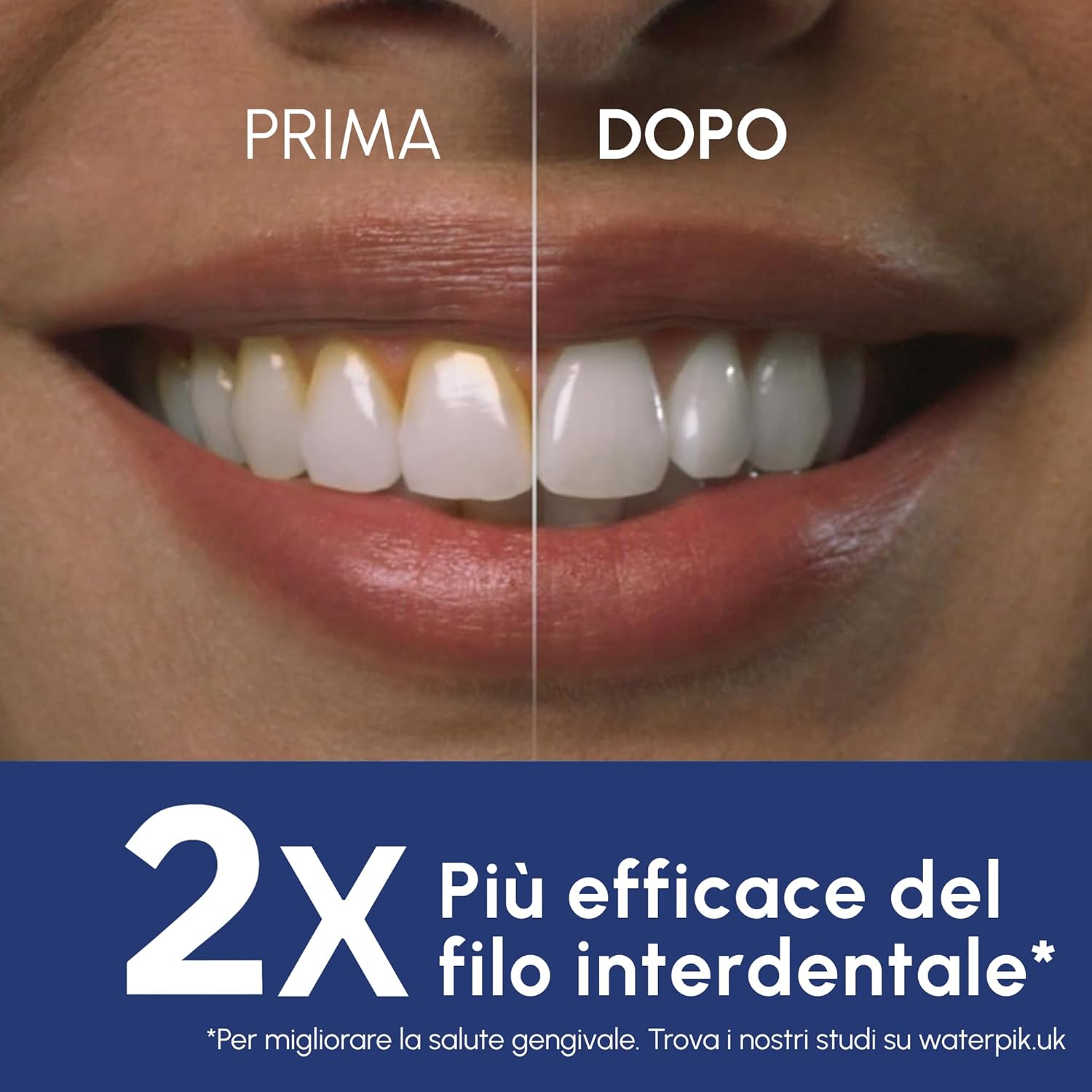 Thumbnail 2 de Waterpik Cordless Pearl idropulsore dentale ricaricabile: portatile e impermeabile, per rimuovere placca e residui