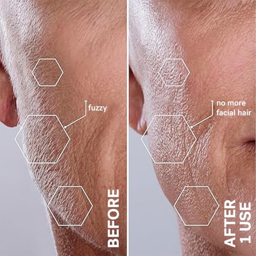 Thumbnail 4 de Michael Todd Sonicsmooth Pro+ Dermaplane with 16 blades