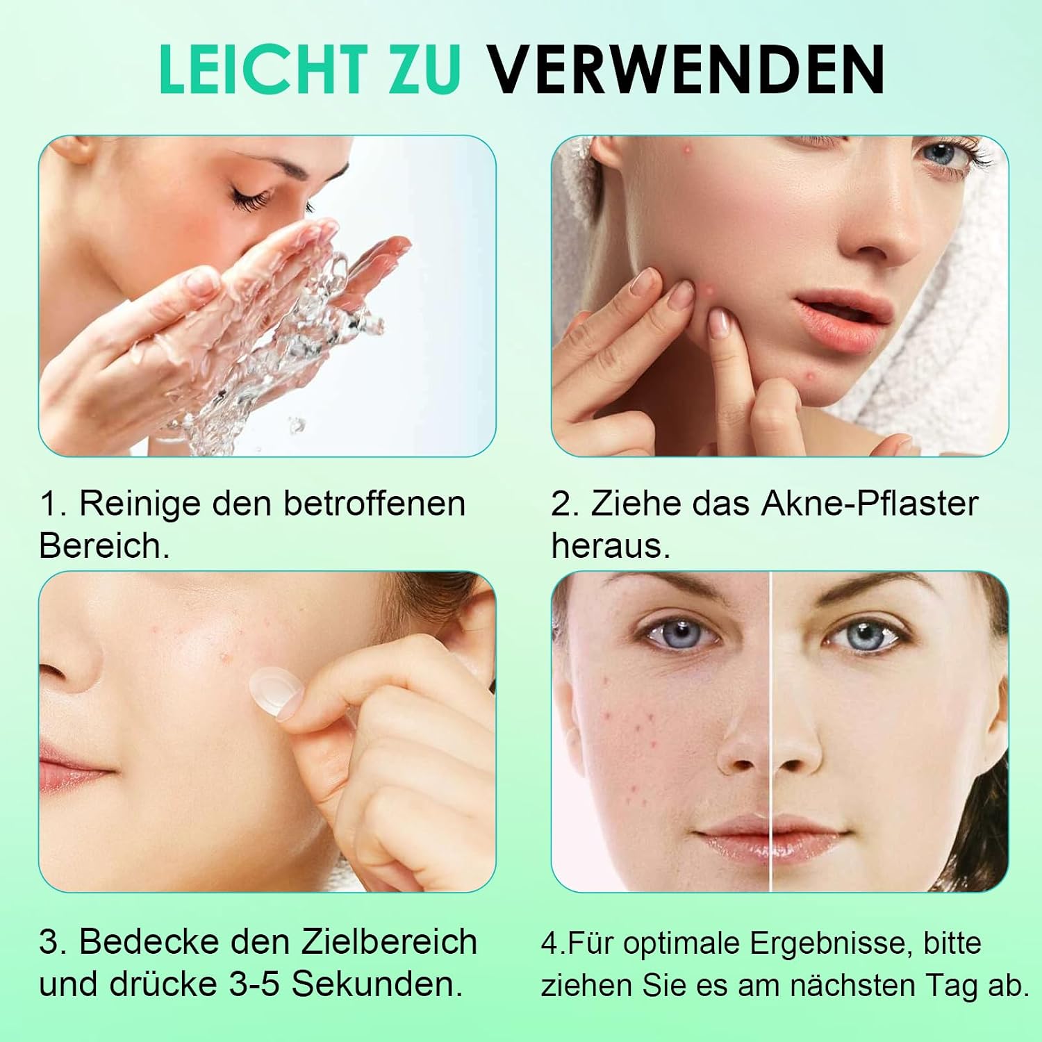 Detalle de Home Holic Pimple Patches 300 Stück