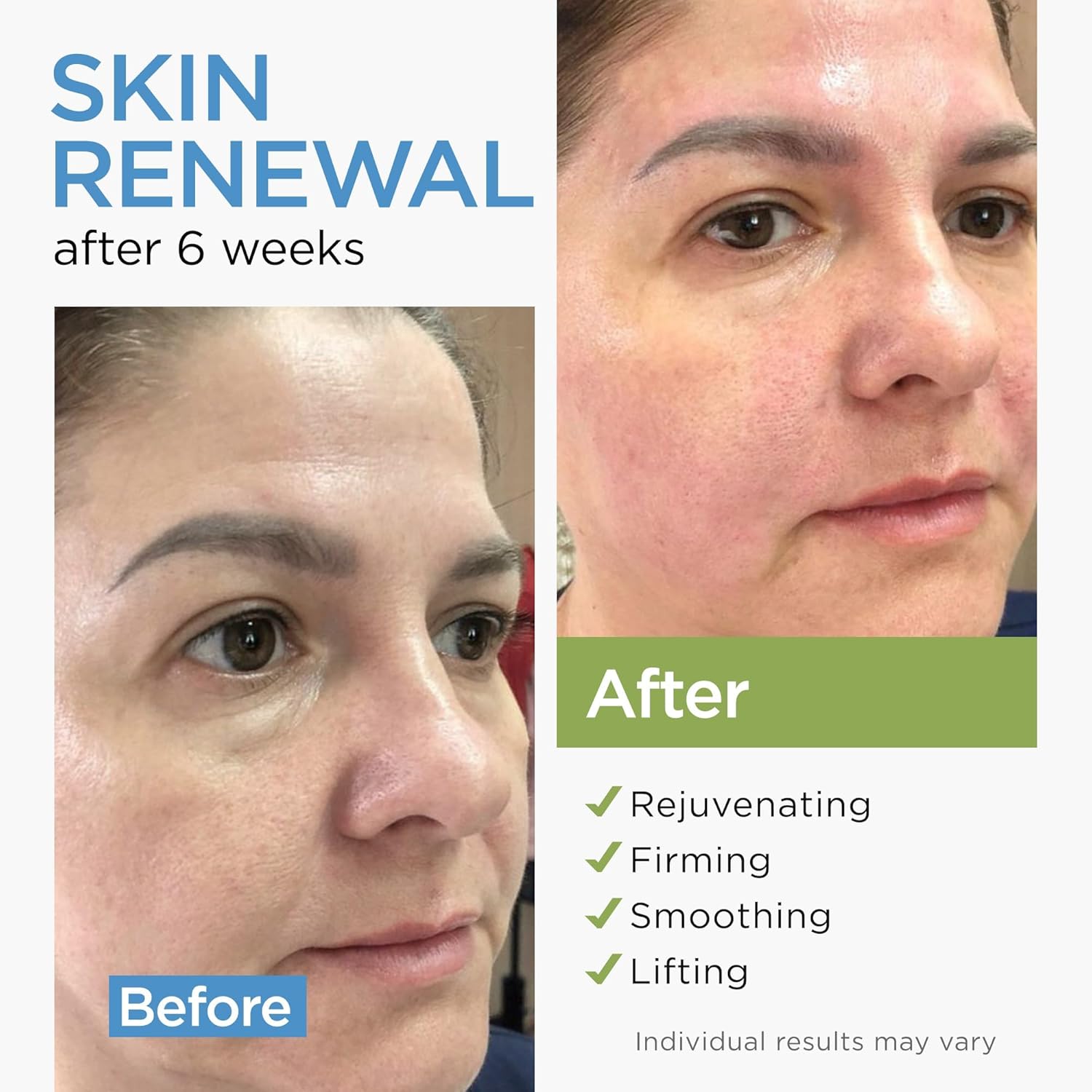 Detalle 2 de Collagen Face Cream with Stem Cells, Retinol, Hyaluronic Acid & Niacinamide (Airless Pump)