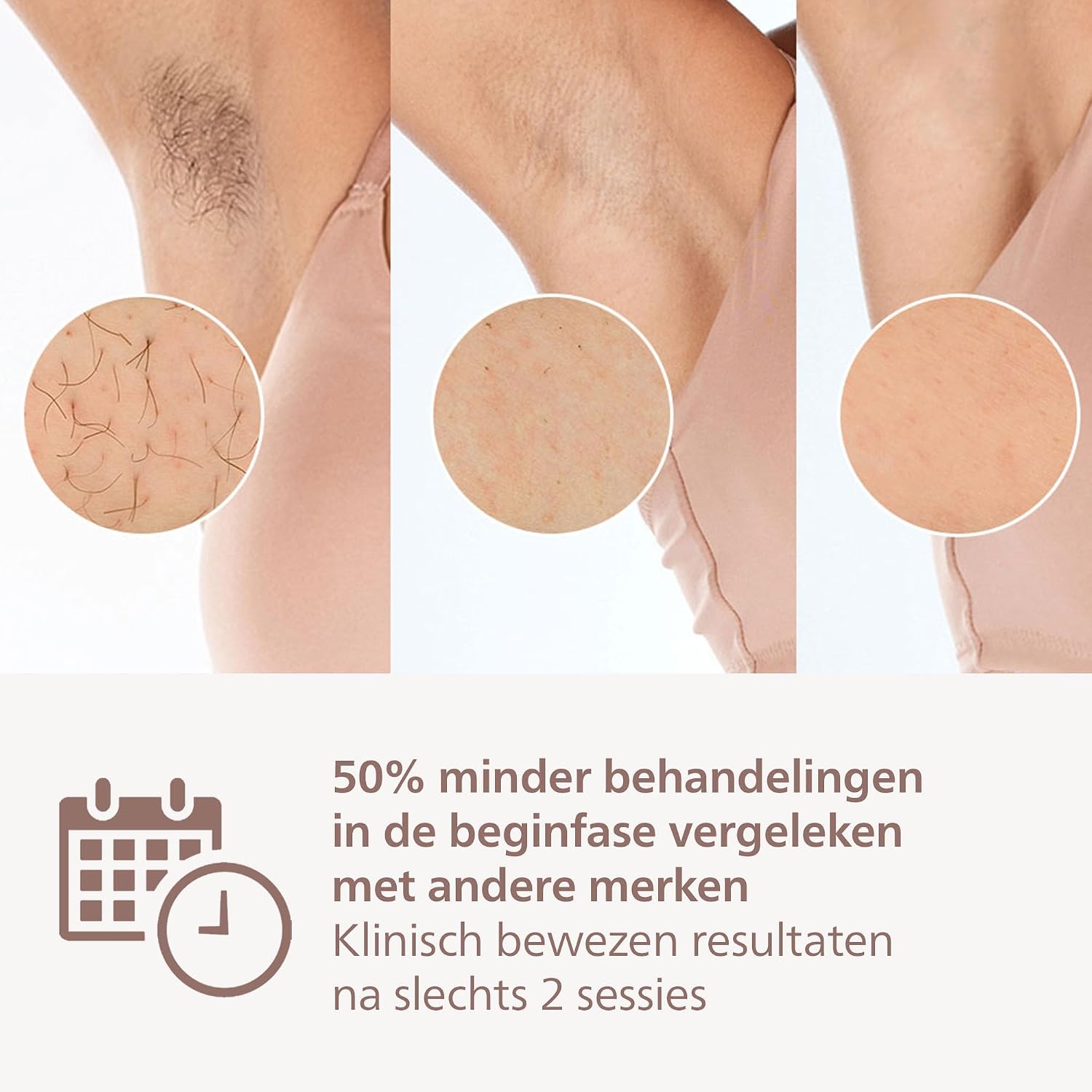 Detalle 2 de Philips Lumea 9000-serie BRI957/00 IPL-ontharingsapparaat met SenseIQ