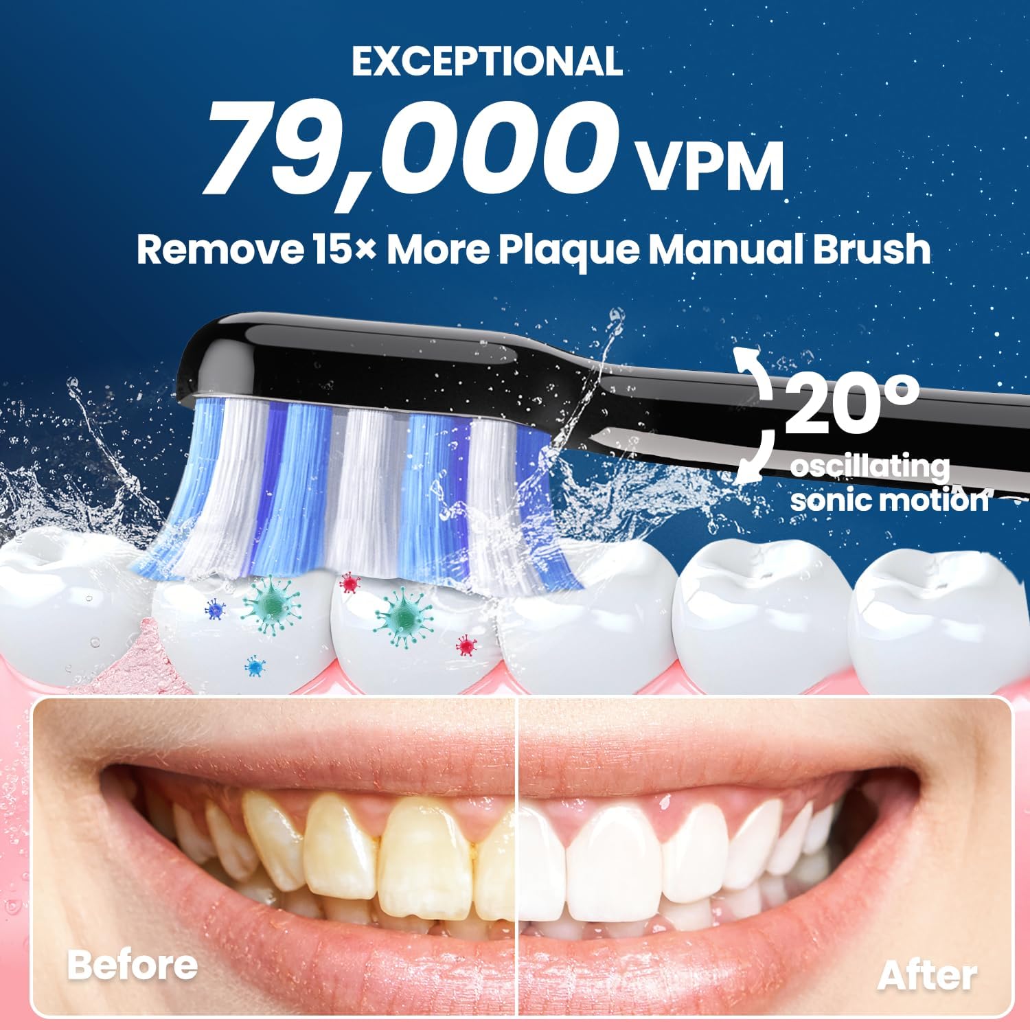 Detalle de Marlincare Electric Toothbrush Black