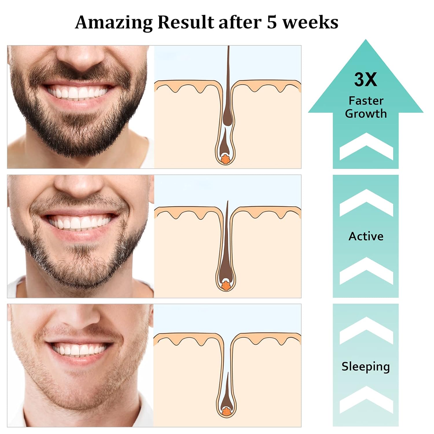 Detalle de RAFFIN Beard Growth Kit with 2oz Beard Growth Oil, 3X Biotin & Castor Oil + Premium Beard Massager