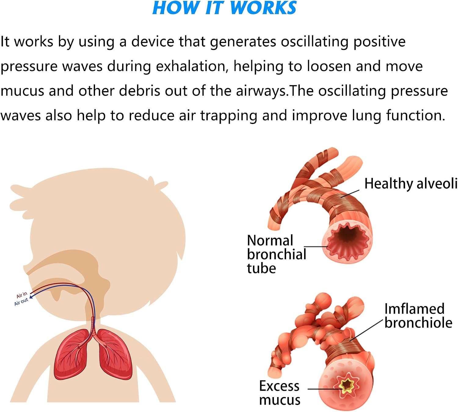 Thumbnail 4 de MillSTEPS Breathing Exercise Device for Lung Expansion
