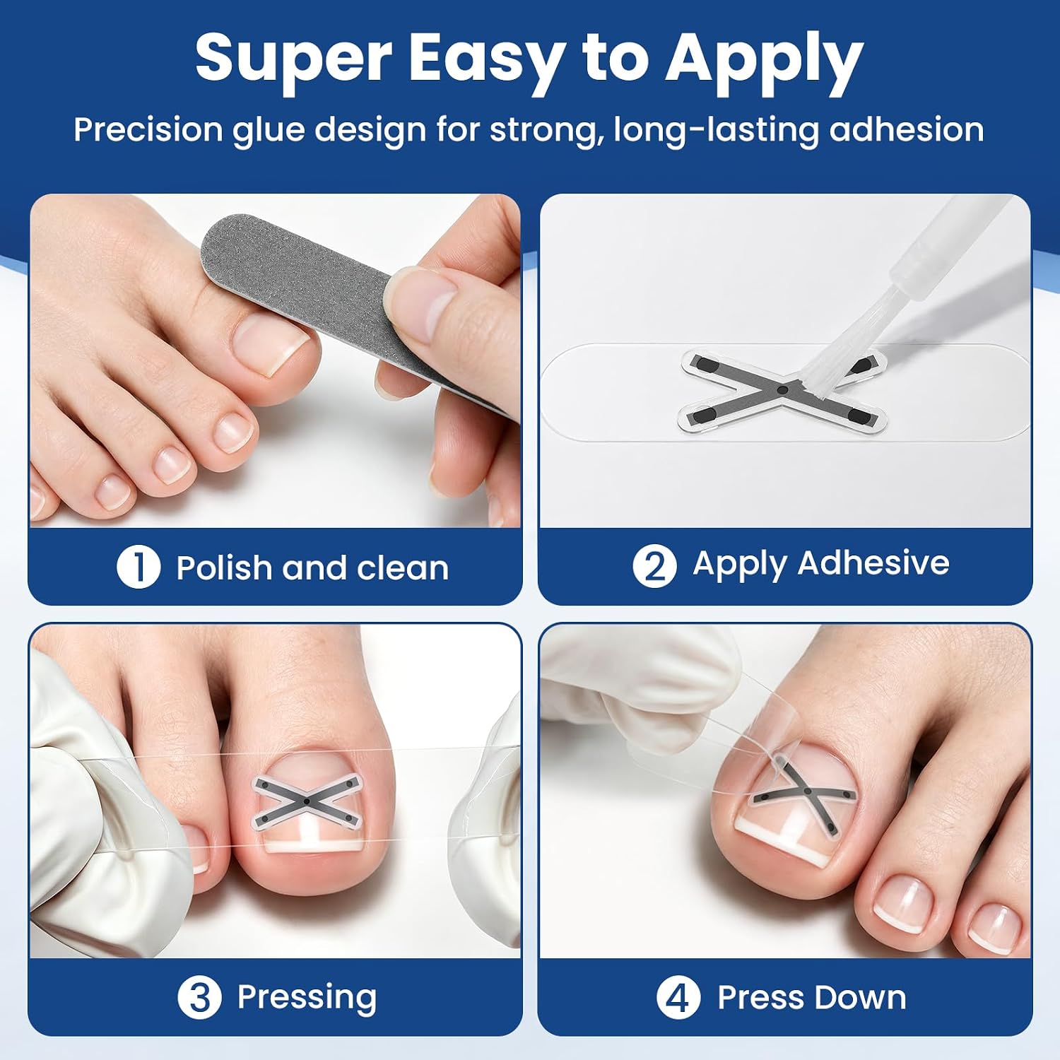 Thumbnail 5 de Ingrown Toenail Corrector, Titanium Alloy