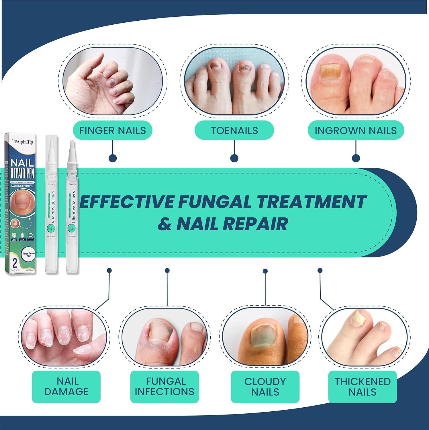 Detalle 2 de AlphaTip Nail Fungus Pen, 2-Pack Gel Treatment for Toenails, 6 mL Each
