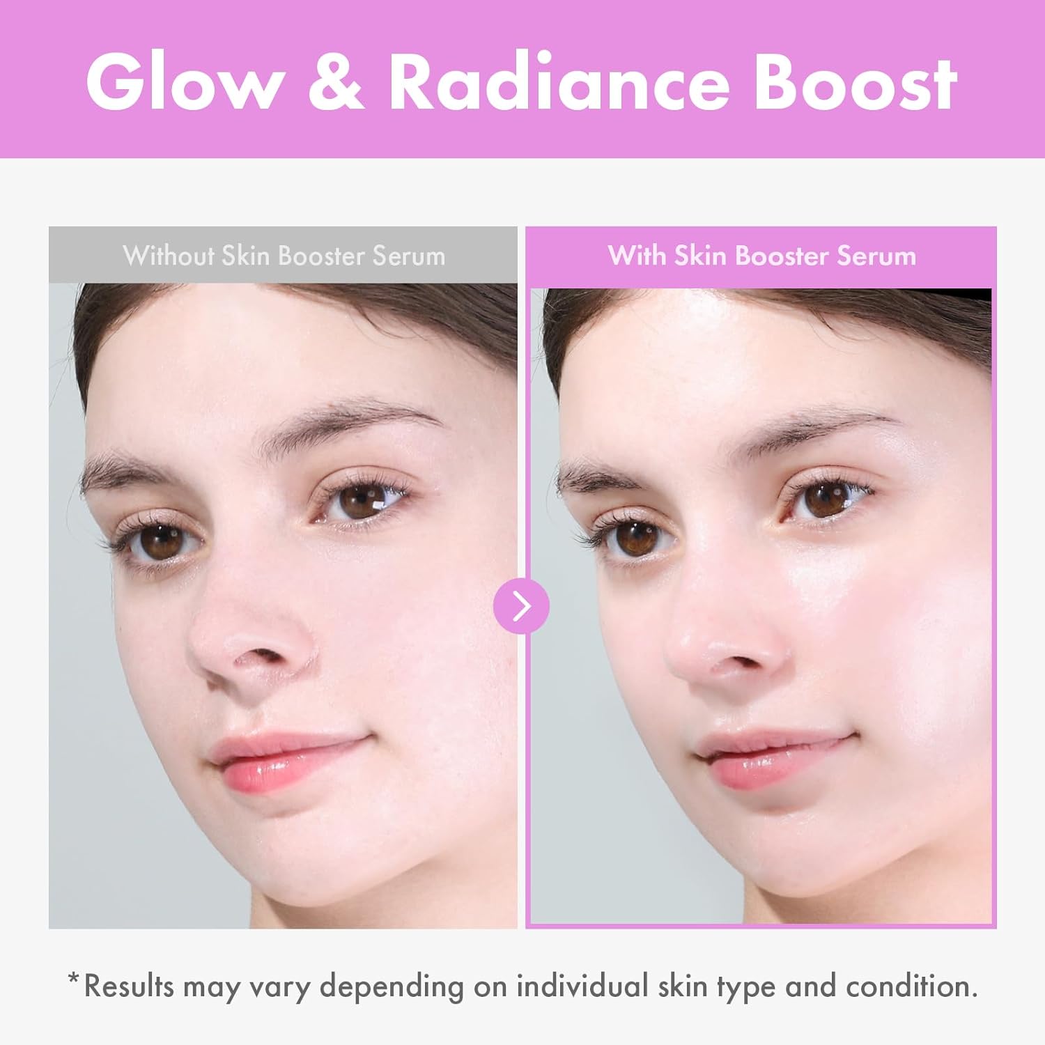 Thumbnail 3 de TOSOWOONG 9 Peptide Skin Booster Siero: siero viso potenziante con 9 peptidi, Niacinamide e acido ialuronico