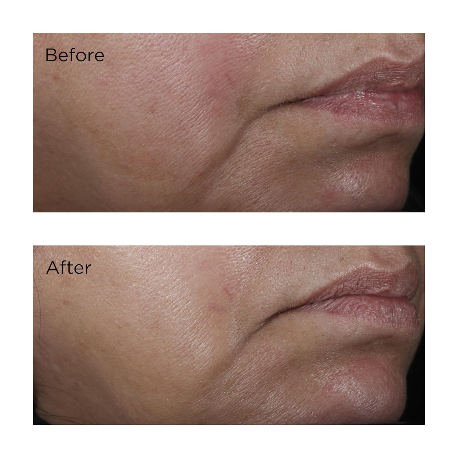 Thumbnail 3 de Perricone MD No:Rinse Intensive Pore Minimizing Toner – 118 ml, DMAE & Salicylsäure