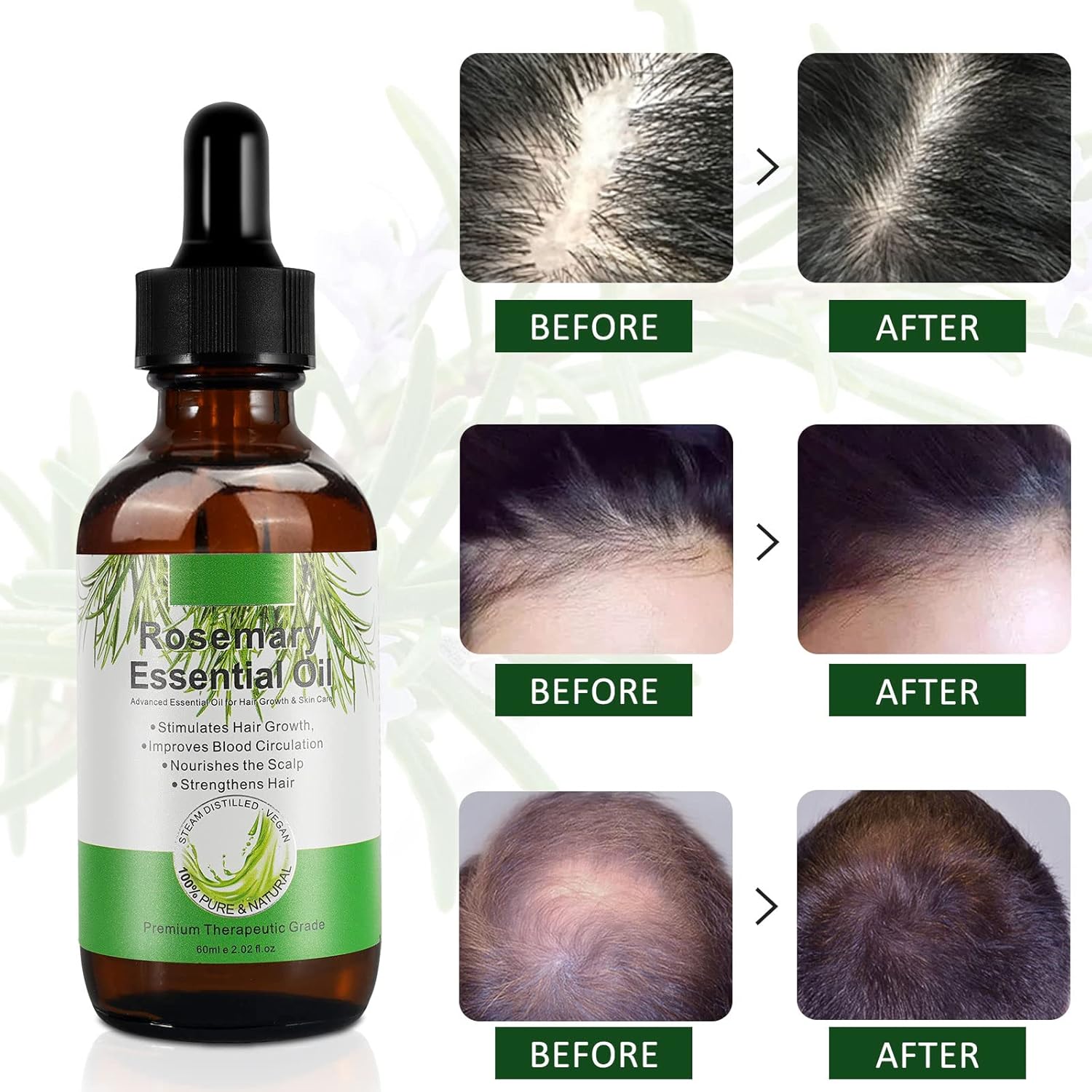 Thumbnail 5 de Huile Essentielle de Romarin VXHDAG – Croissance des cheveux et soin de la peau, 60ML (2 packs) – 100% Pure