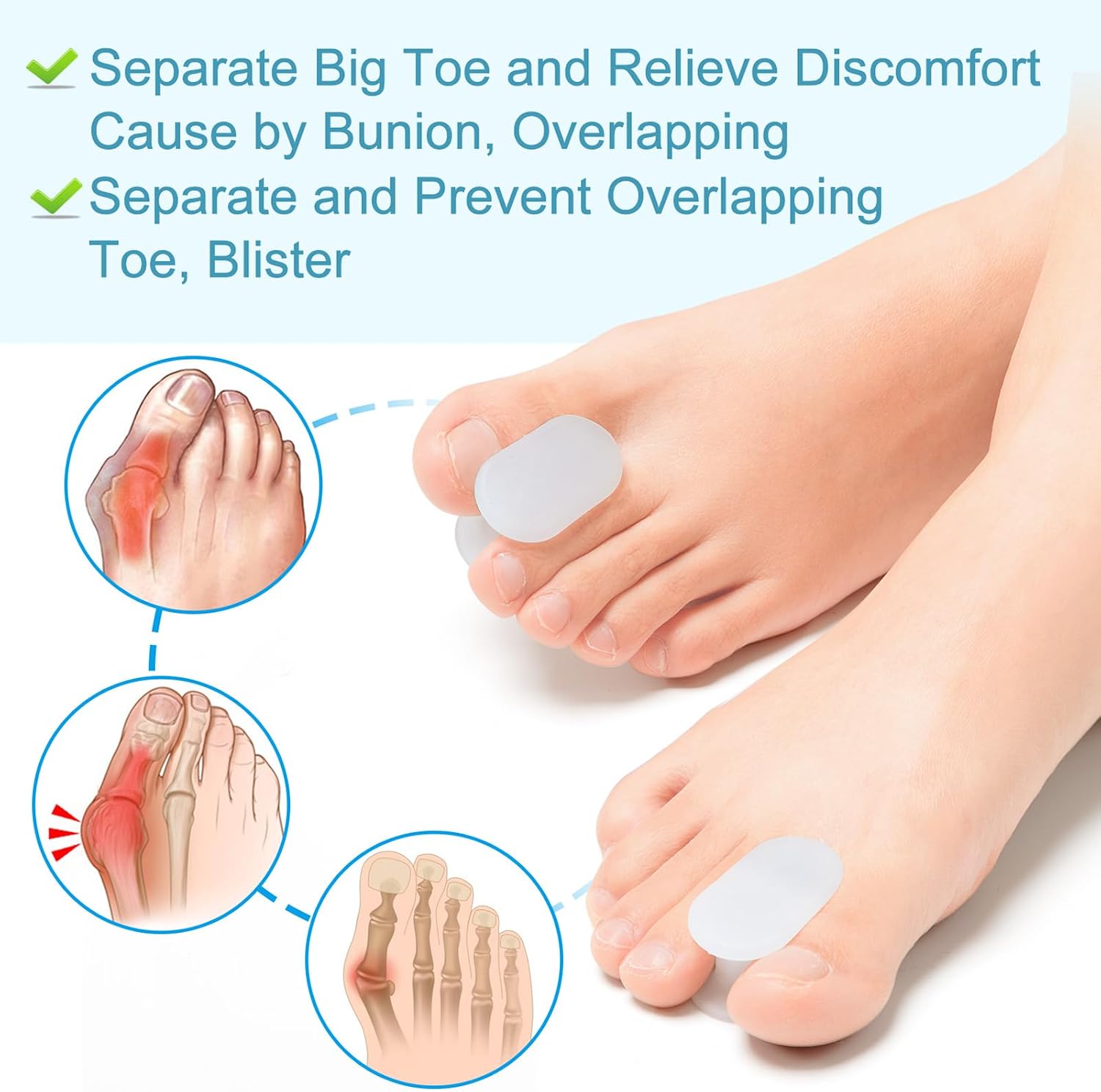 Detalle 2 de Povihome Large Silicone Toe Spacers, 1/2-Inch for Bunions