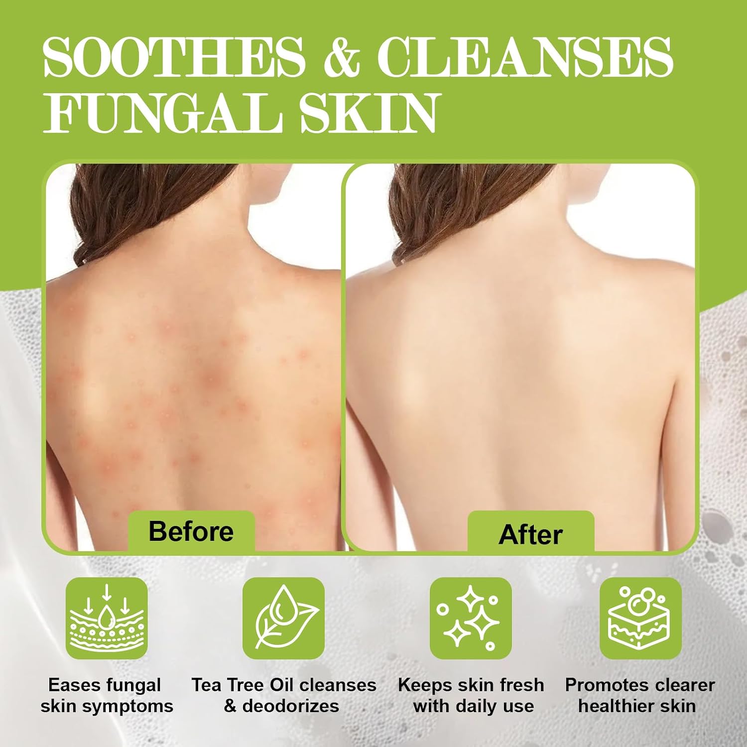 Detalle de NXPPYY Antifungal Soap Bar with Tolnaftate and Tea Tree Oil, 3-Pack