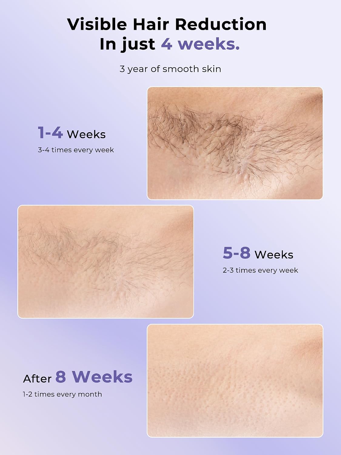 Thumbnail 5 de Ubroo IPL Hair Removal with 5°C Ice Cooling – Hand-Held Full-Body Laser Hair Removal (Purple)