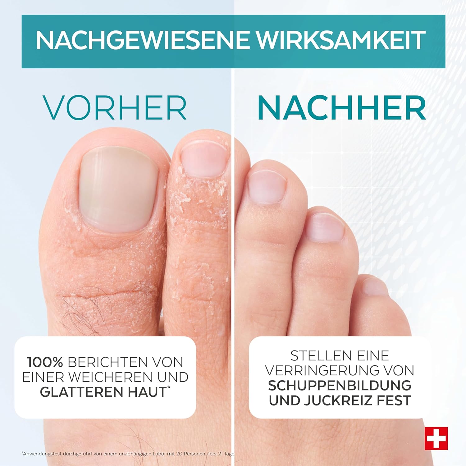 Detalle de PODERM 3-in-1 Pilzspray für Nägel, Füße & Schuhe (Teebaum, Zink & Minze) – Swiss Made