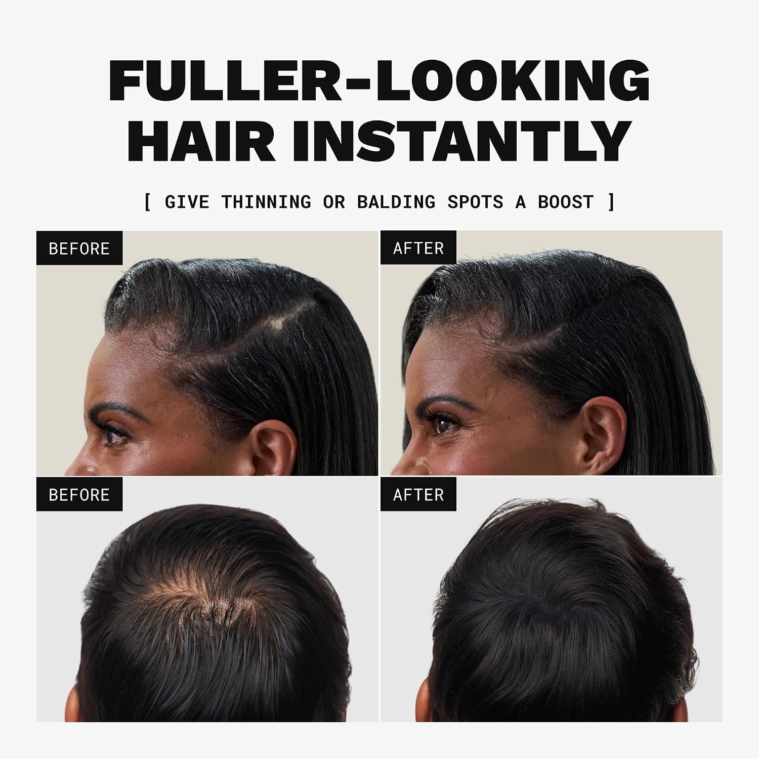 Detalle de TOPPIK Fibres capillaires densifiantes à la kératine, Brun – couvrance naturelle pour racines, ligne frontale et barbe
