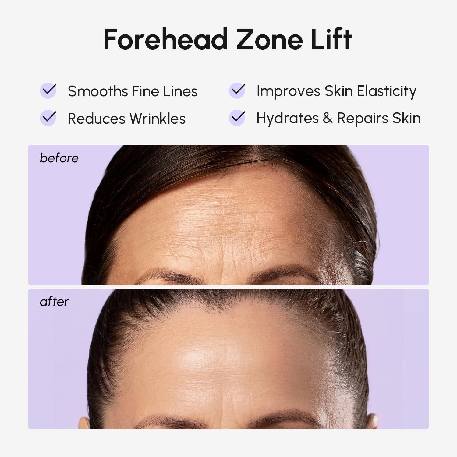 Detalle de MAREE Forehead Wrinkle Patches for Deep Lines ðŸŽ