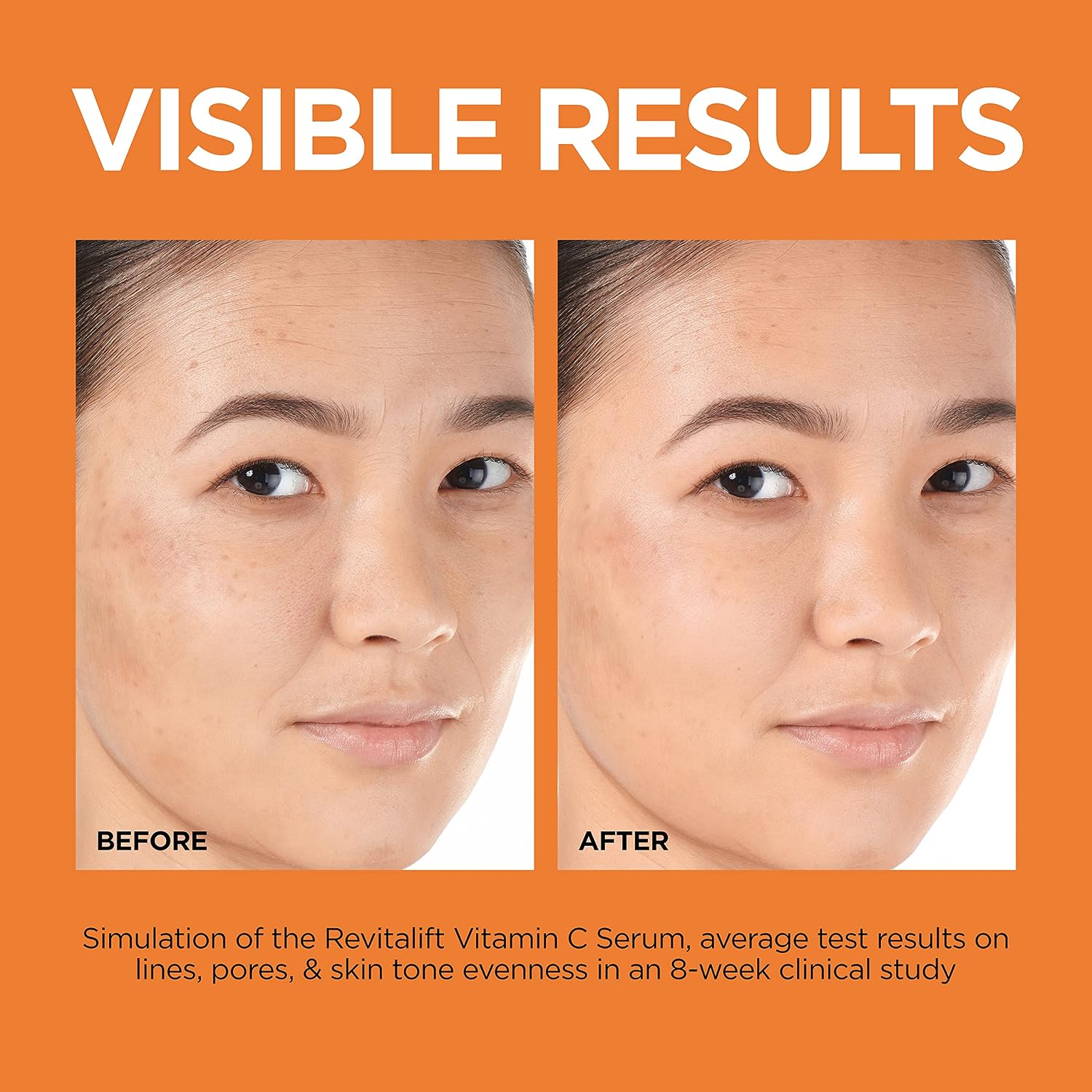 Thumbnail 5 de L'Oréal Paris Revitalift 12% Pure Vitamin C Serum, 1 oz with Vitamin E